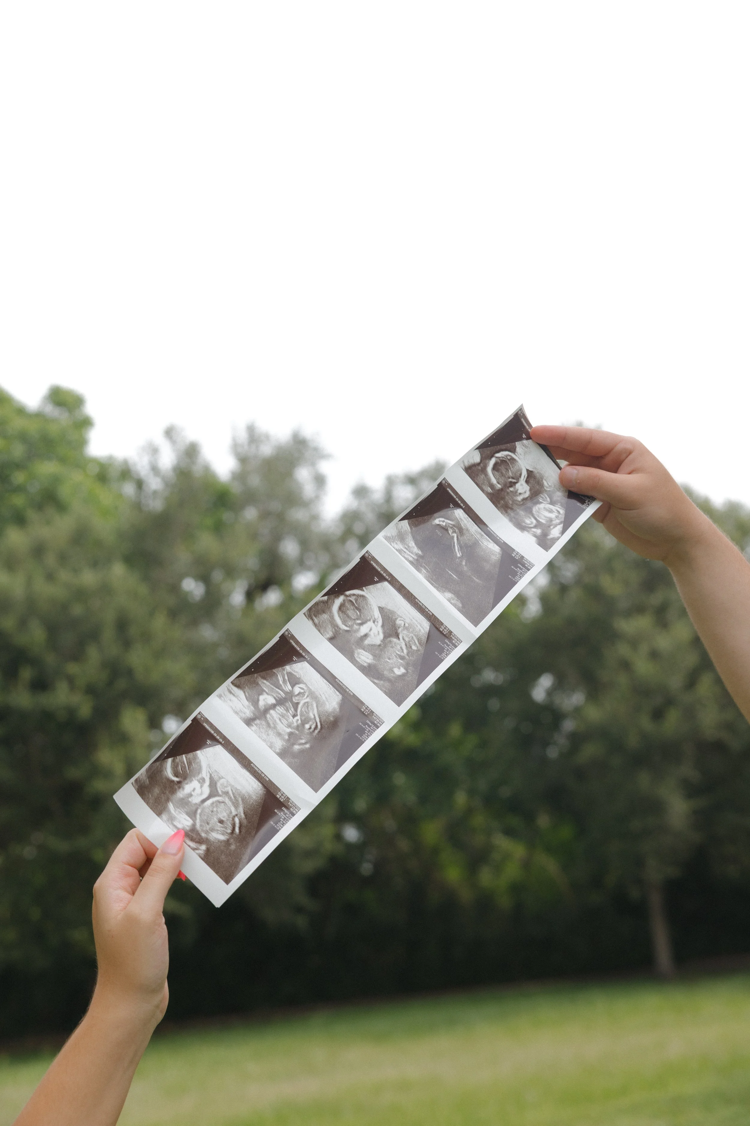Person holding a series of ultrasound images outdoors against a background of trees and sky.