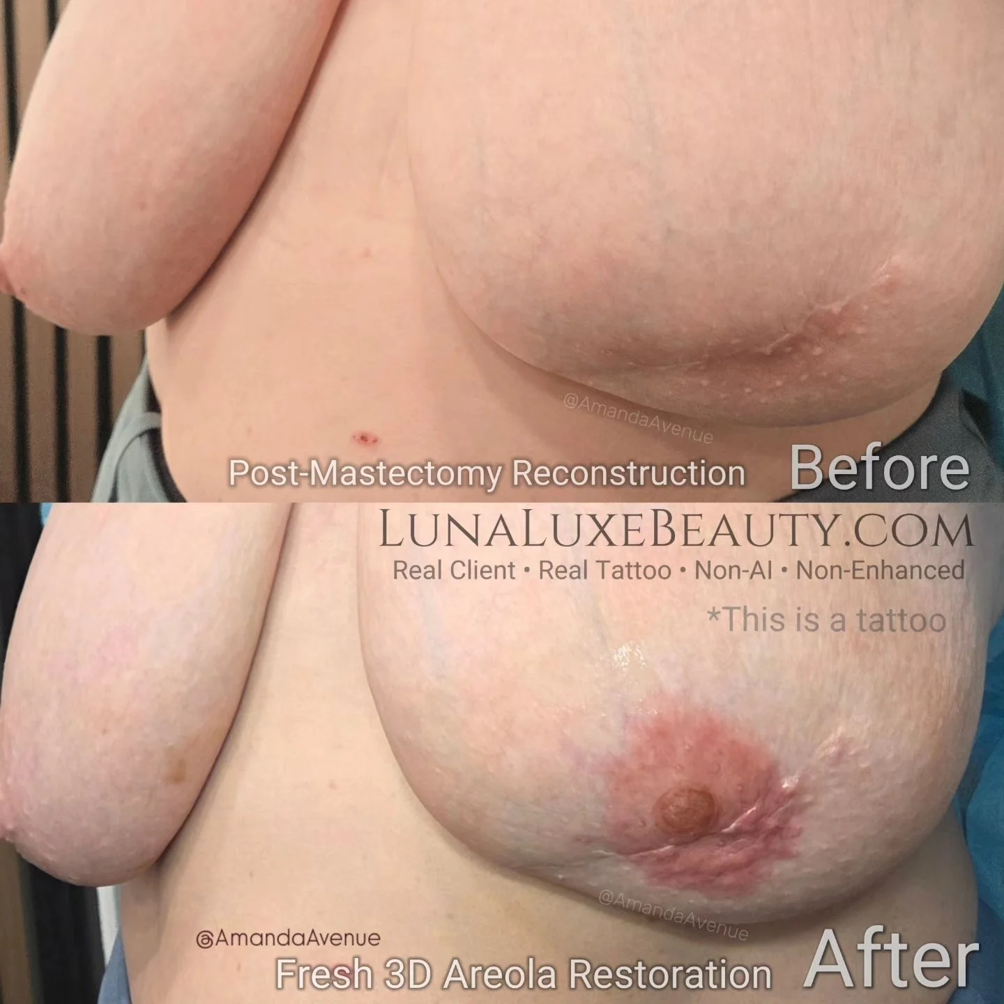 Before and after 3D areola restoration showing realistic unilateral areola tattoo artistry by Amanda Avenue.