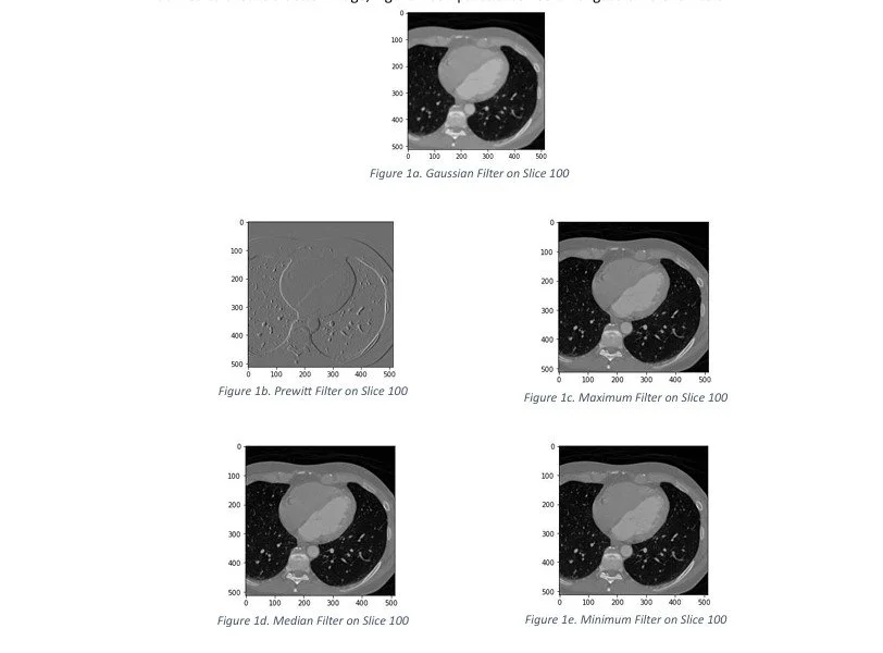 Soft Tissue of CT images filtered through