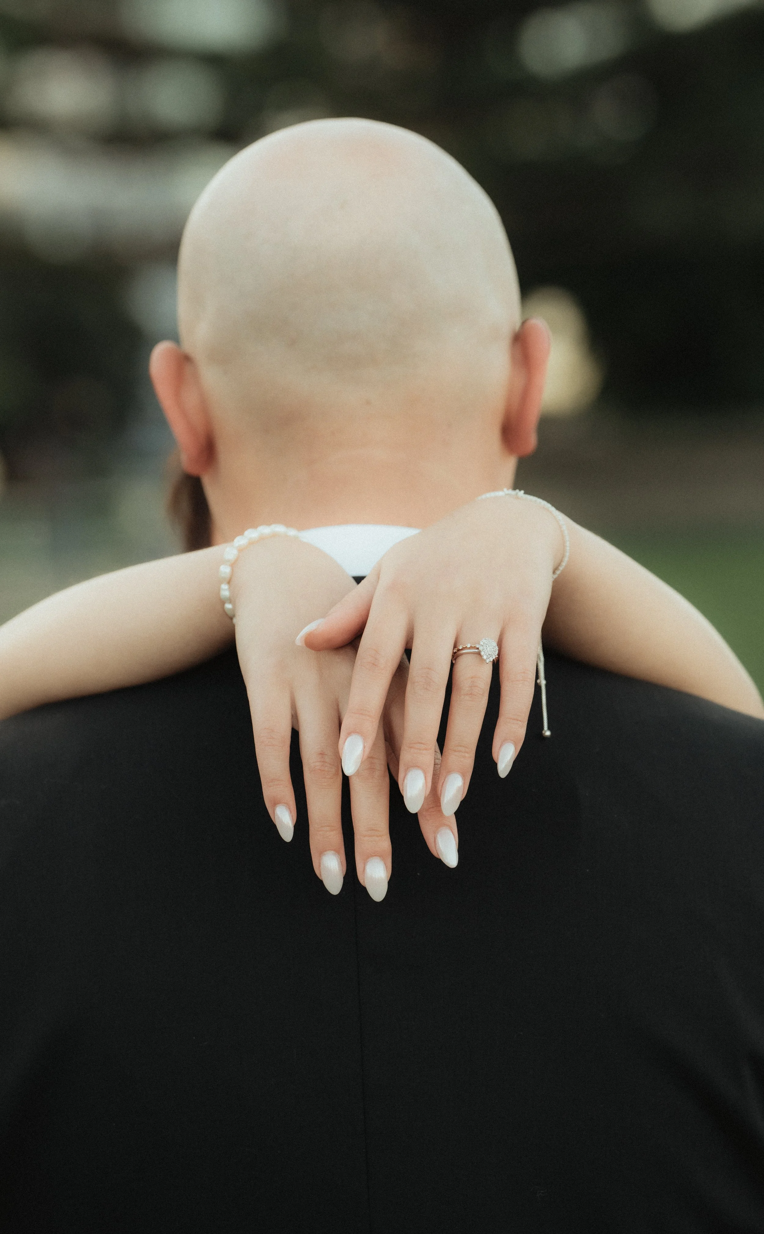 Back of a person's head with a bald scalp, wearing a ring, a bracelet, and French manicured nails, with their arms crossed over a person's shoulders.