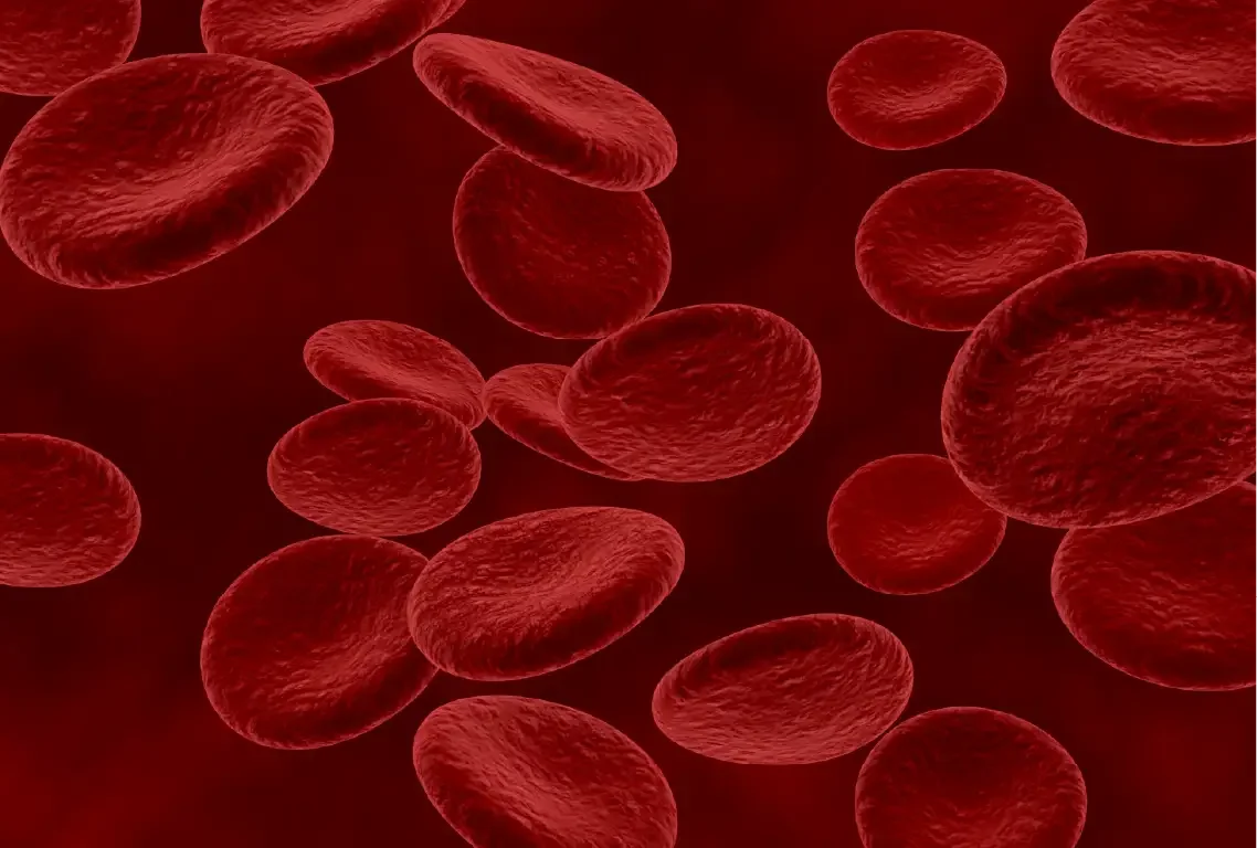 anemia