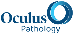 Oculus
