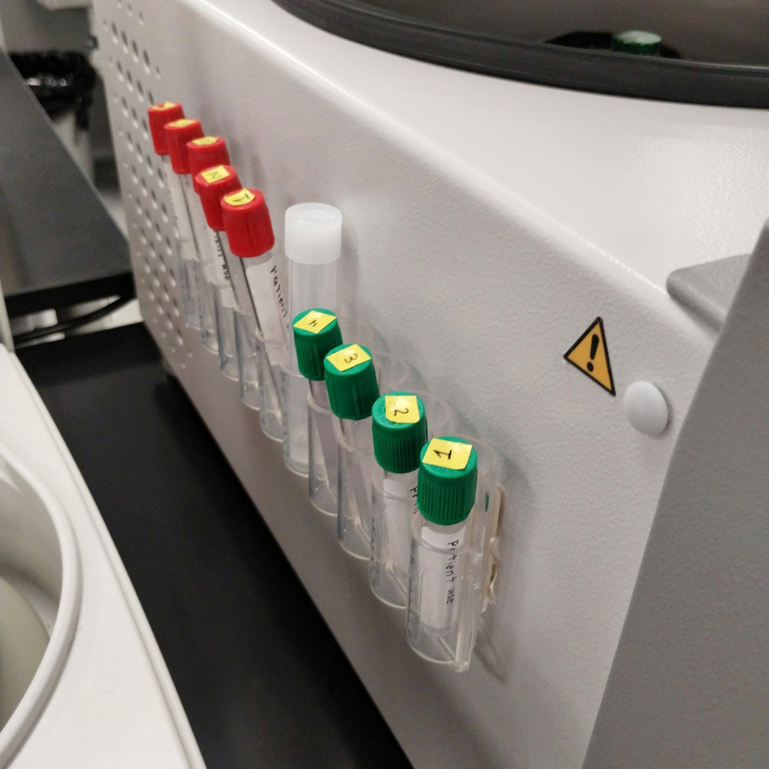 Set of labeled test tubes with yellow and green caps, numbered 1 to 4, mounted on a white lab equipment surface with a caution sign.