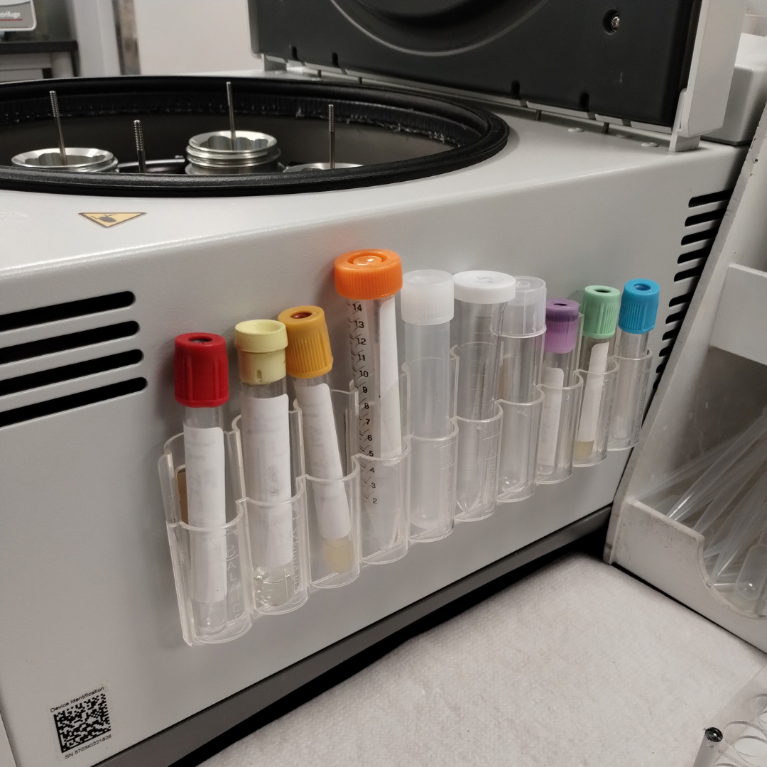 Laboratory centrifuge with capped test tubes in holder attached to the side.