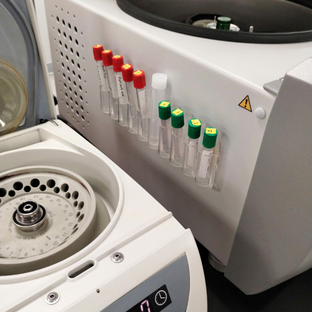 Laboratory centrifuge with test tubes containing sample labels, one test tube on top of the centrifuge, and a warning sticker on the side.