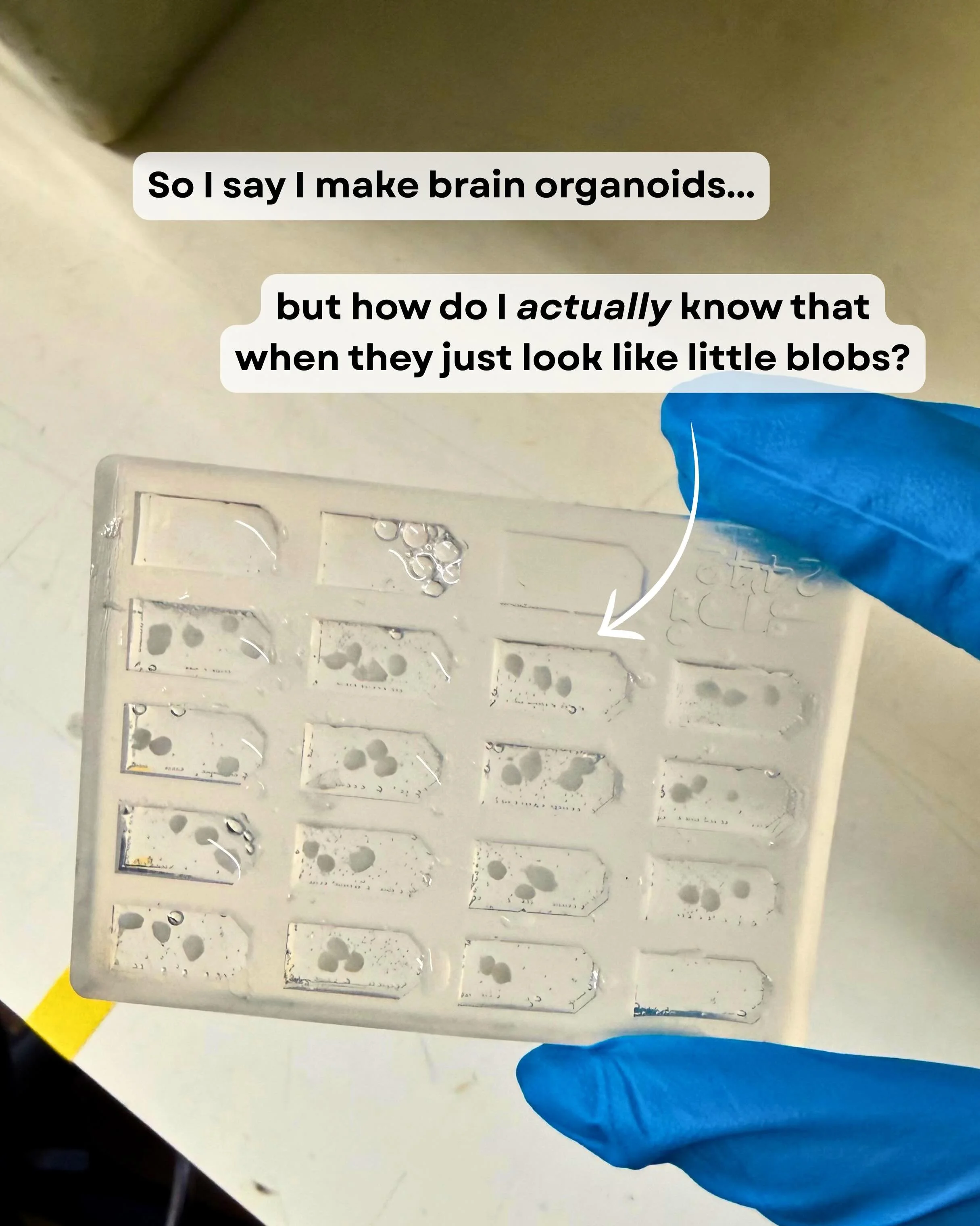 This post is very much inspired by having just finished my first draft of the very chapter where I have to convince my examiners I have indeed made brain organoids 🤣🧠🔬 

#womeninstem #brainorganoids #neuroscience #scienceiscool #phdstudent
