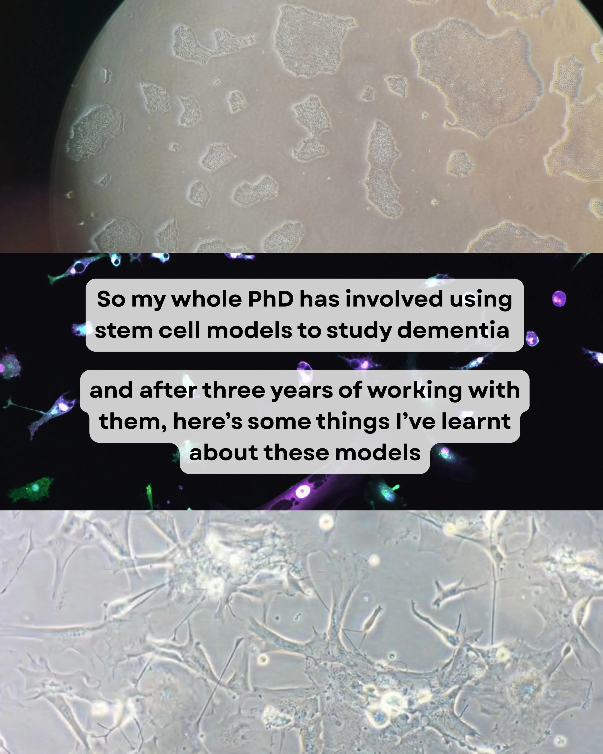 Here&rsquo;s what I&rsquo;ve learnt about stem cell models! Let me know what kind of models you&rsquo;re using ⬇️ 

#phdstudent #stemcellresearch #brainorganoids #neuroscience