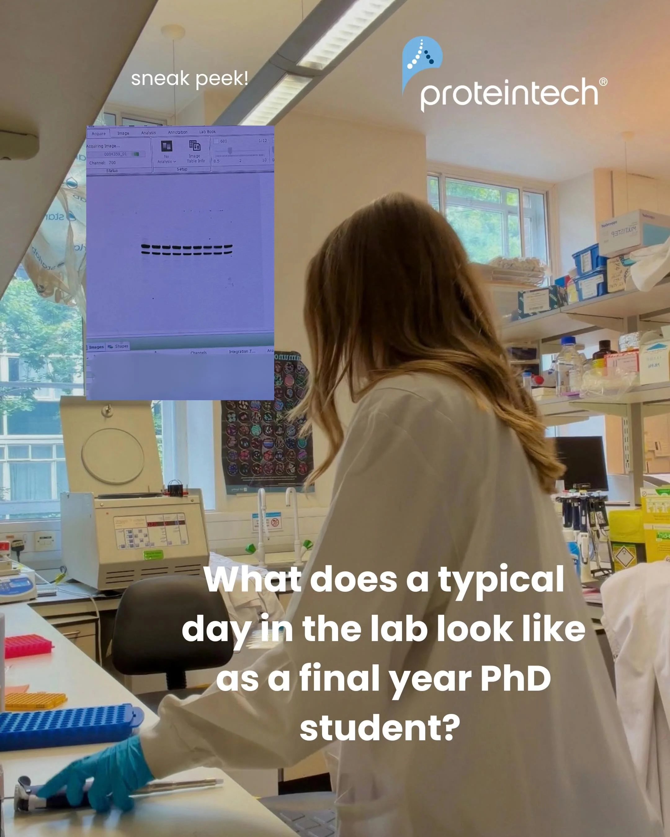 What does a typical day in the lab look like for a final year PhD student? 🧠🥼Swipe through to see what most of my lab days look like, featuring me using a&nbsp;@proteintech antibody which&nbsp;saved me a lot of time (and stress)!