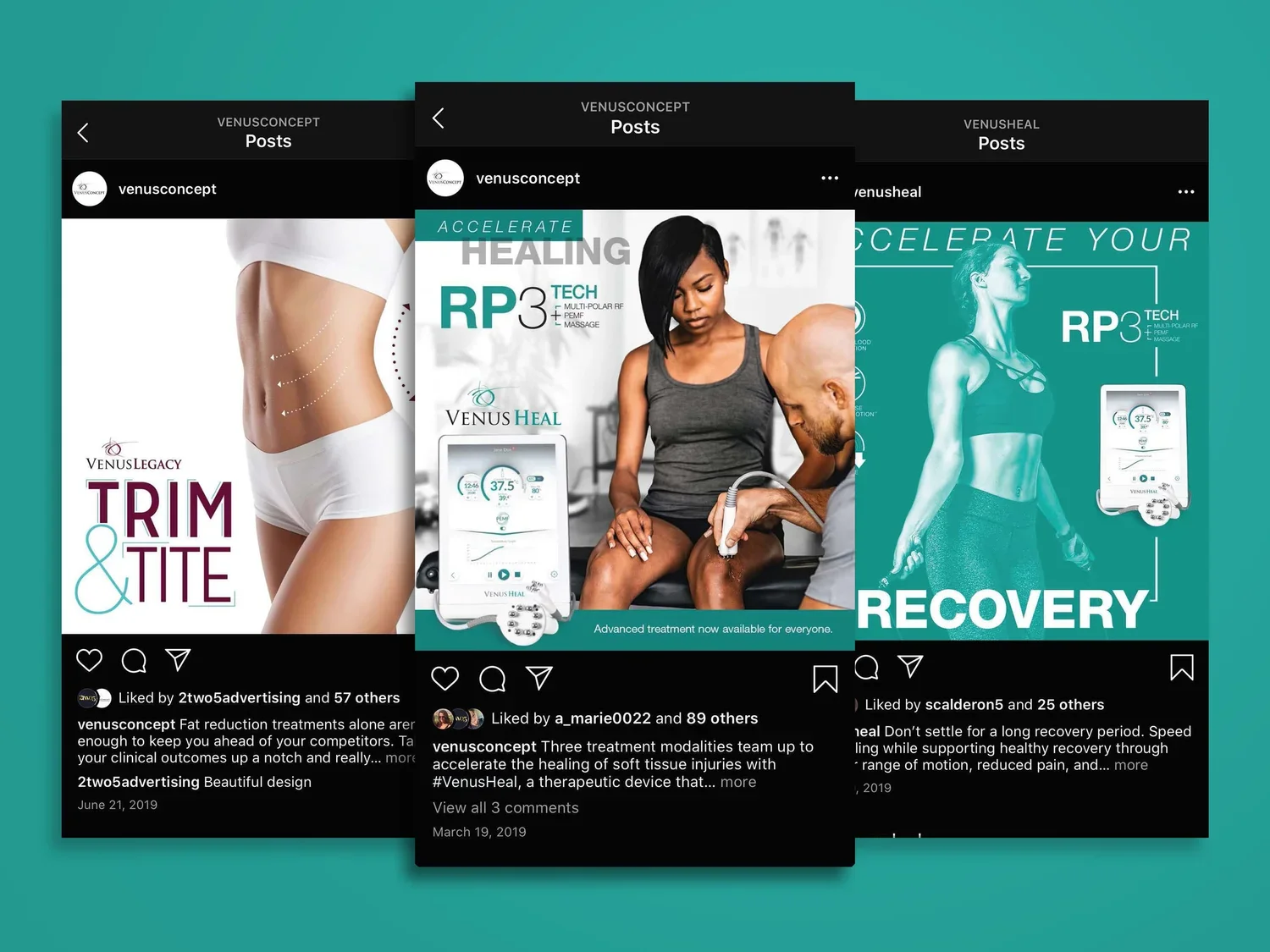 Venus Concept digital campaign shown across mobile and social touchpoints