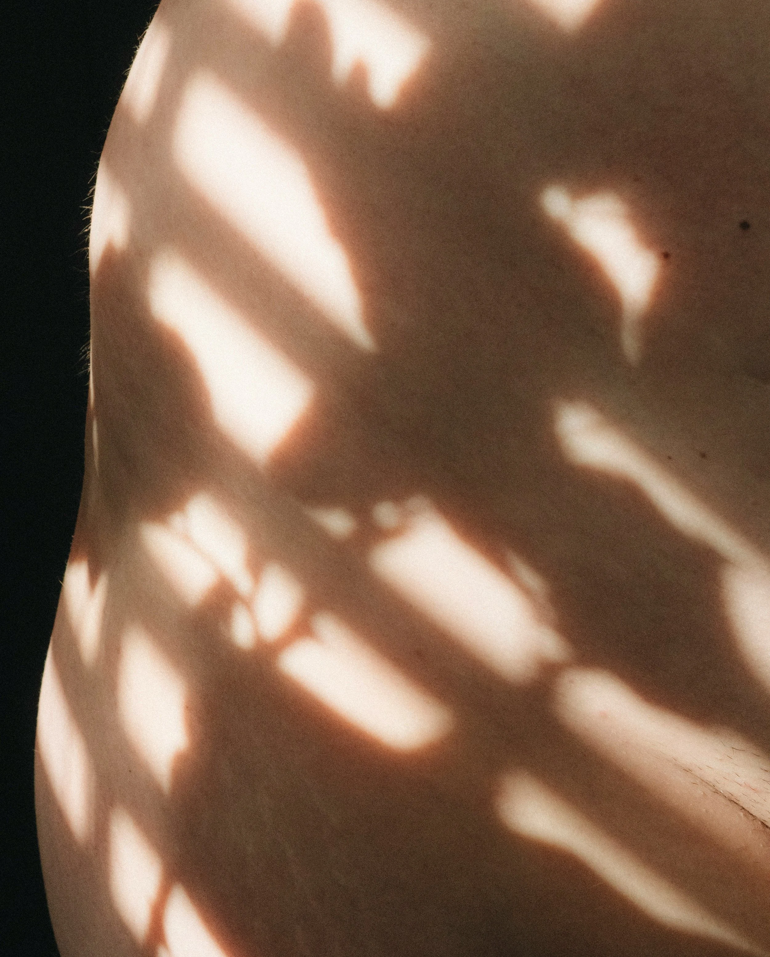 Detalle de piel con sombras de hojas proyectadas.