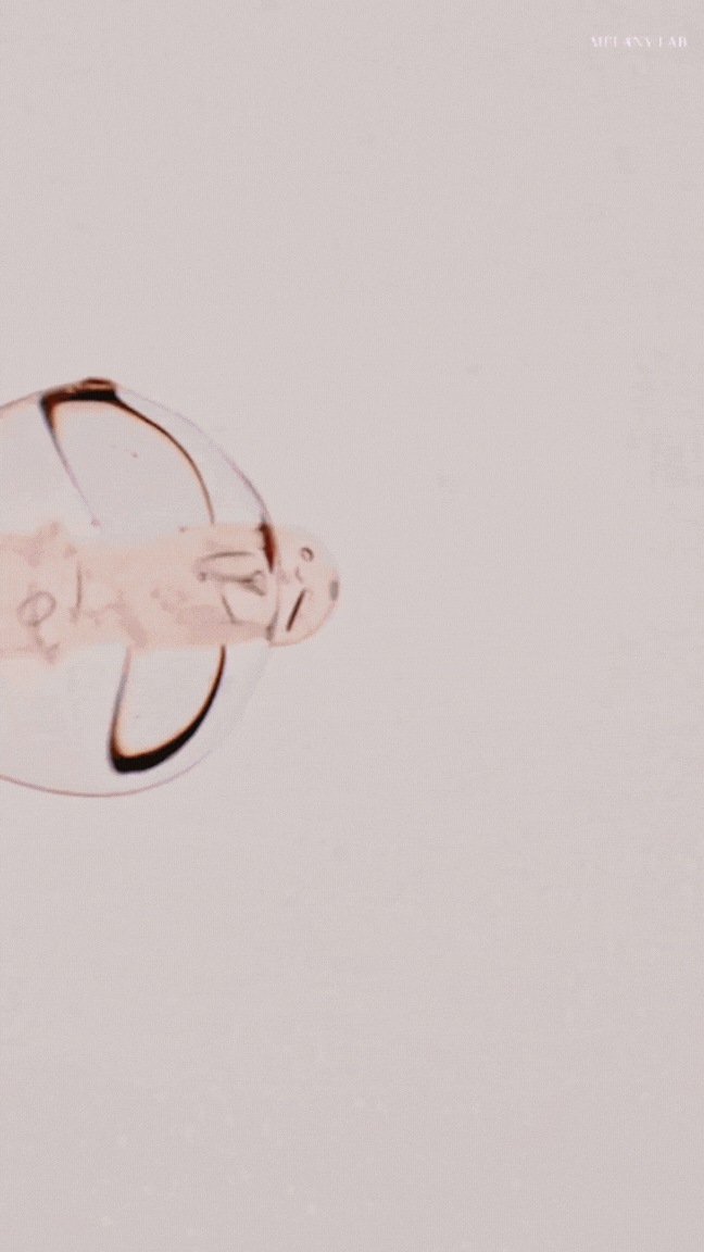 Advanced Peptide Infusion Set MELANY LAB.gif