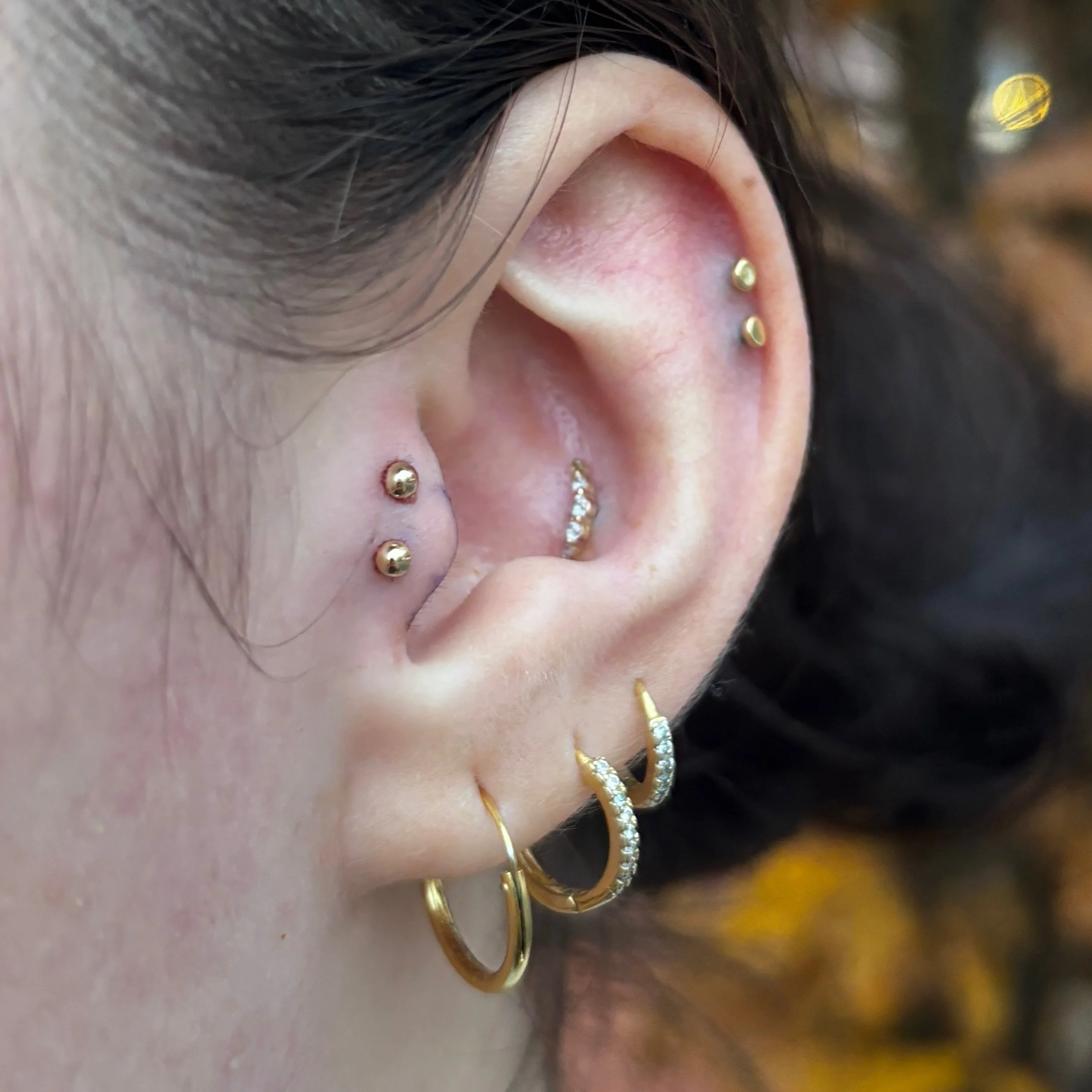 Double Tragus