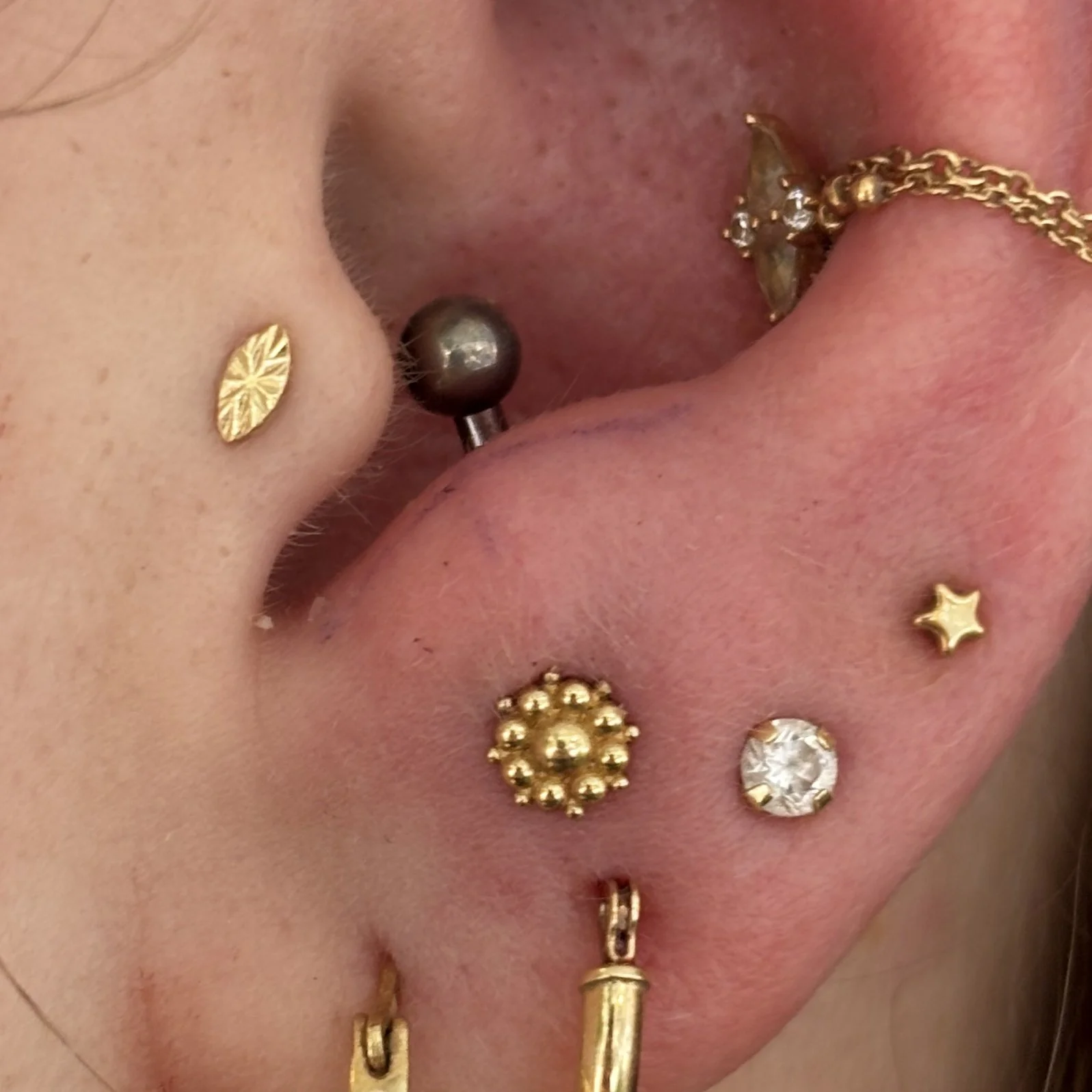 Anti-Tragus