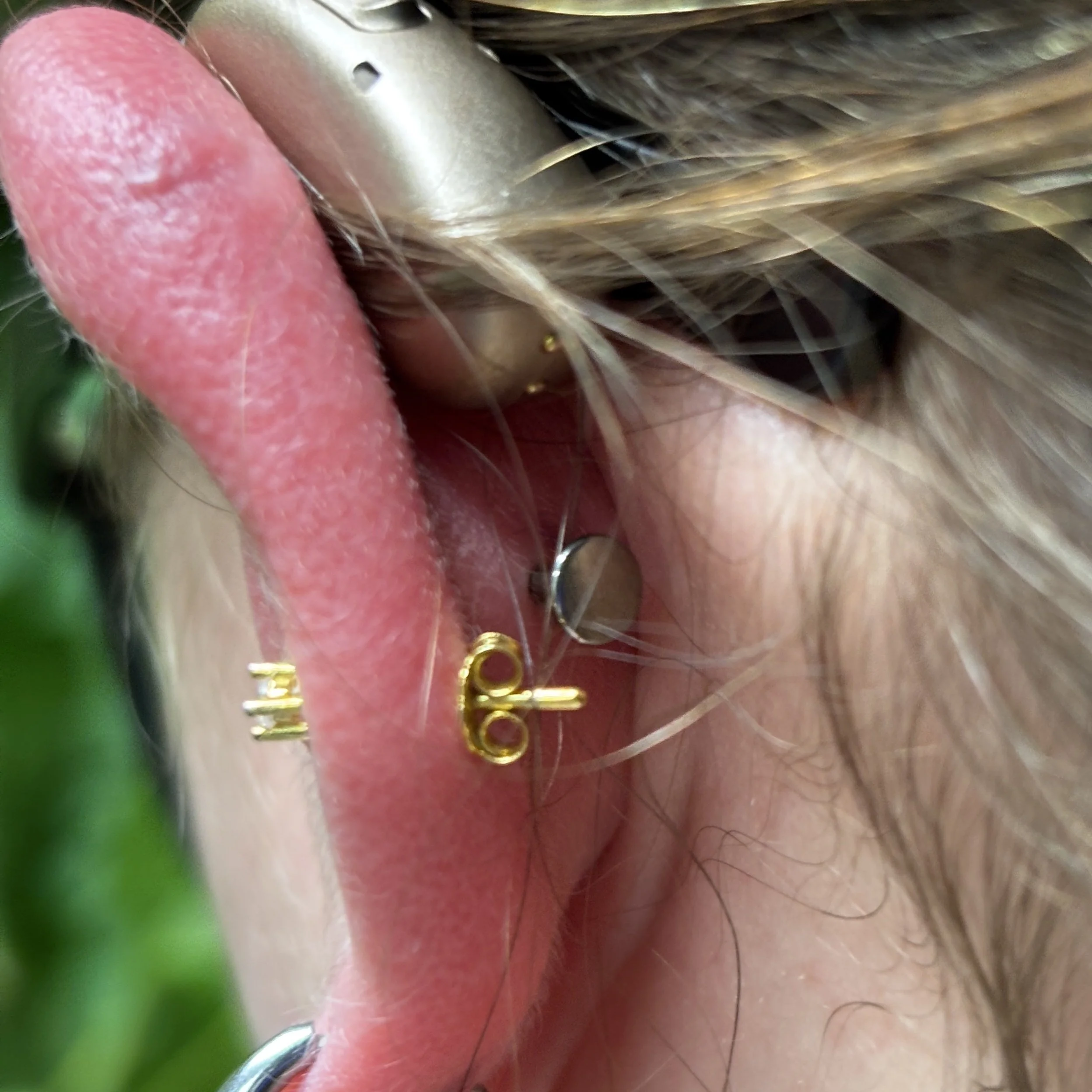 Conch (around hearing aid)