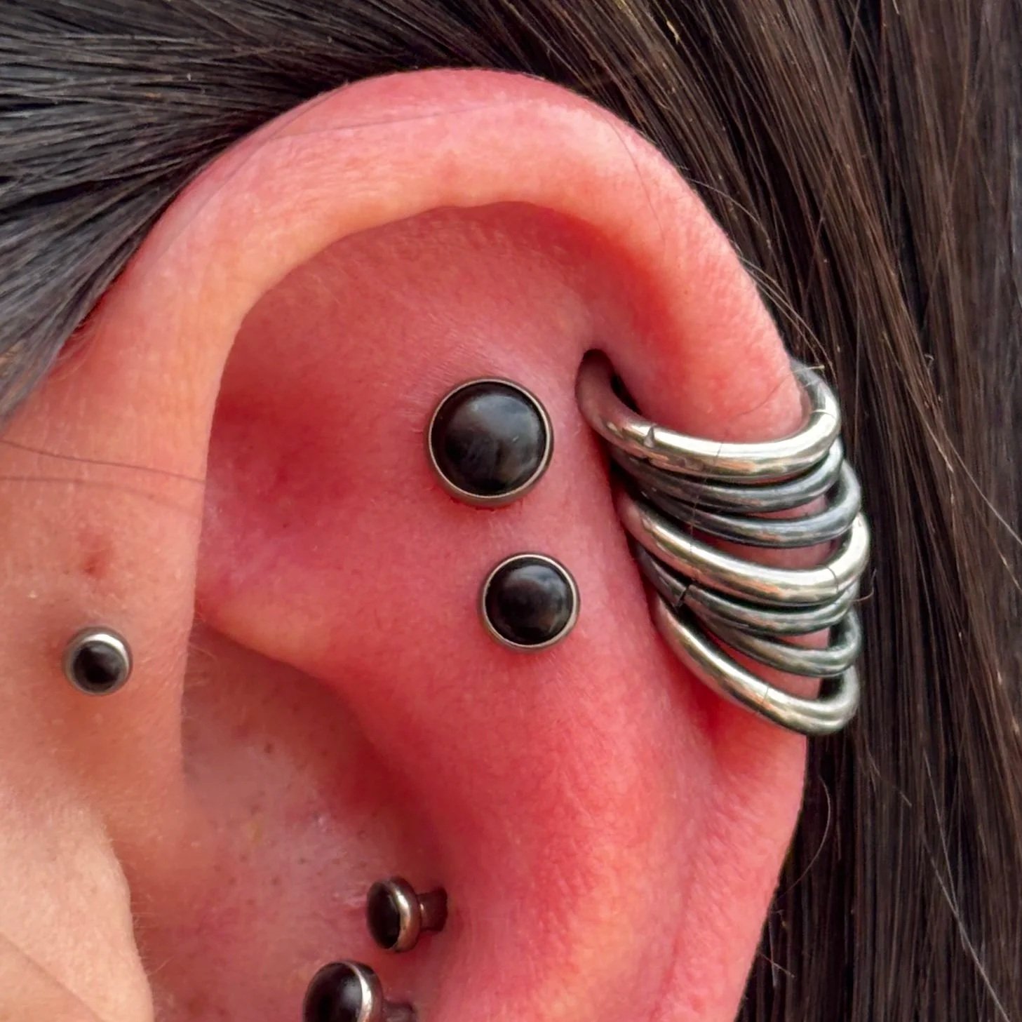 Fresh: Double Flat, & Healed Double Conch