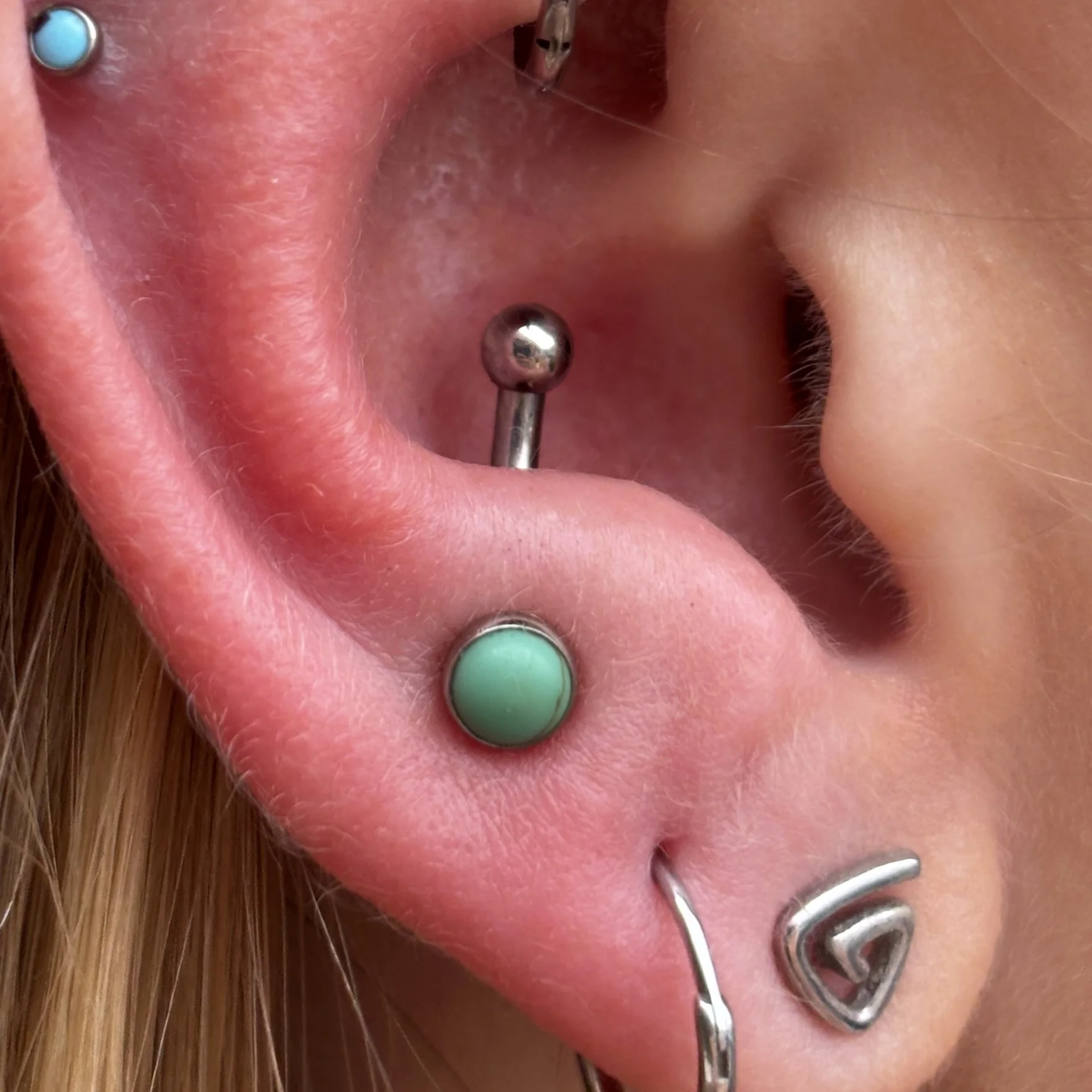 Healed Rook & Fresh Anti-Tragus