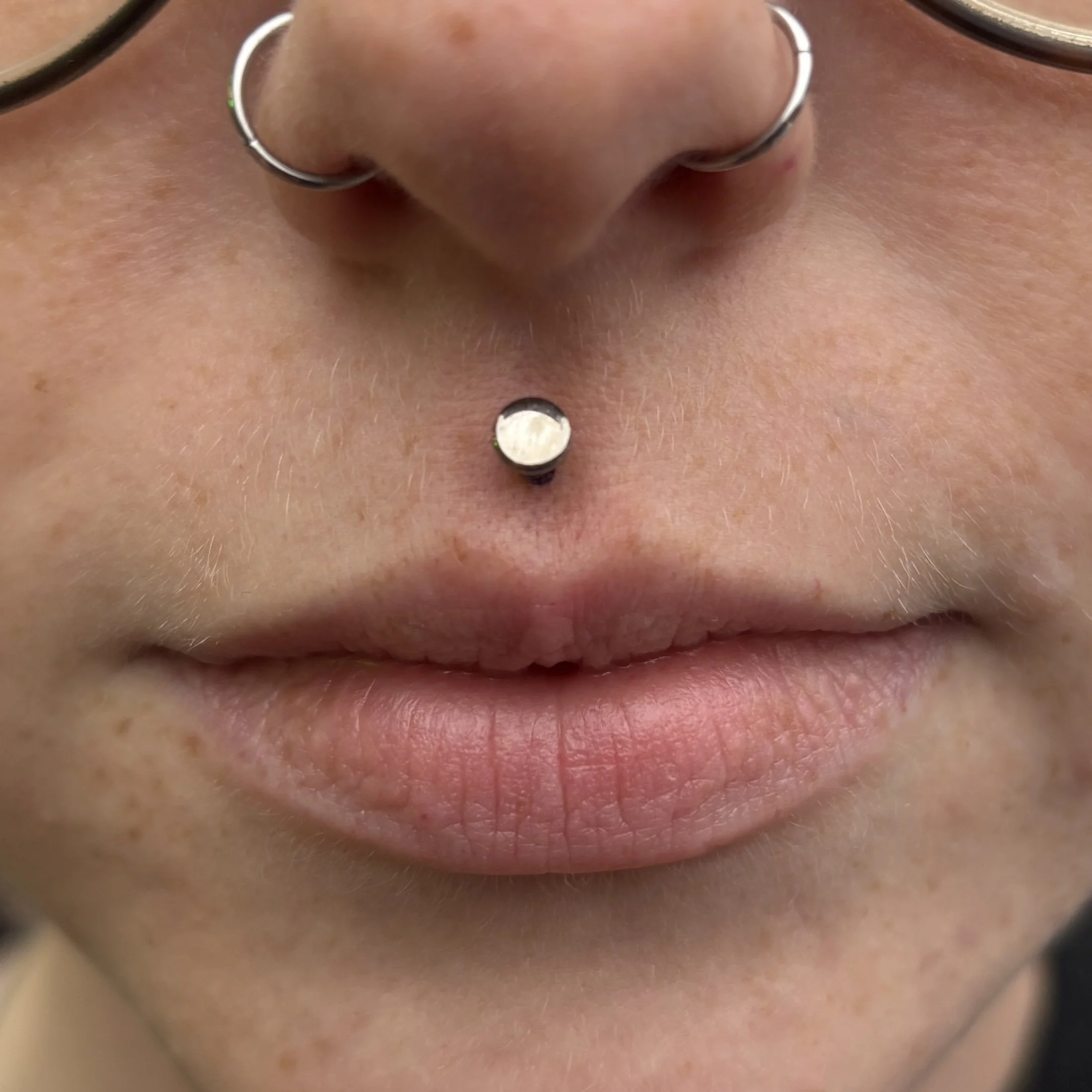 Fresh Philtrum