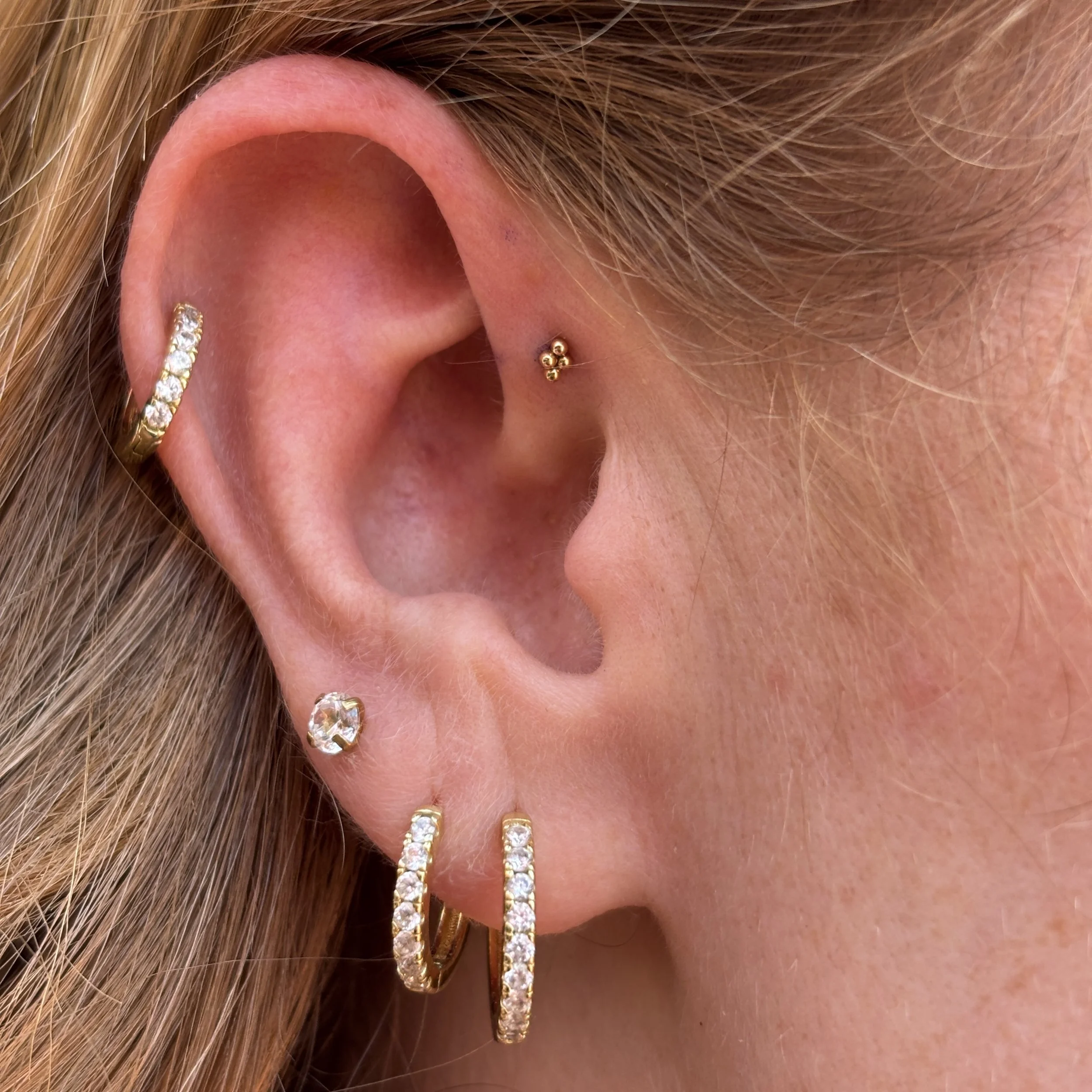Forward Helix