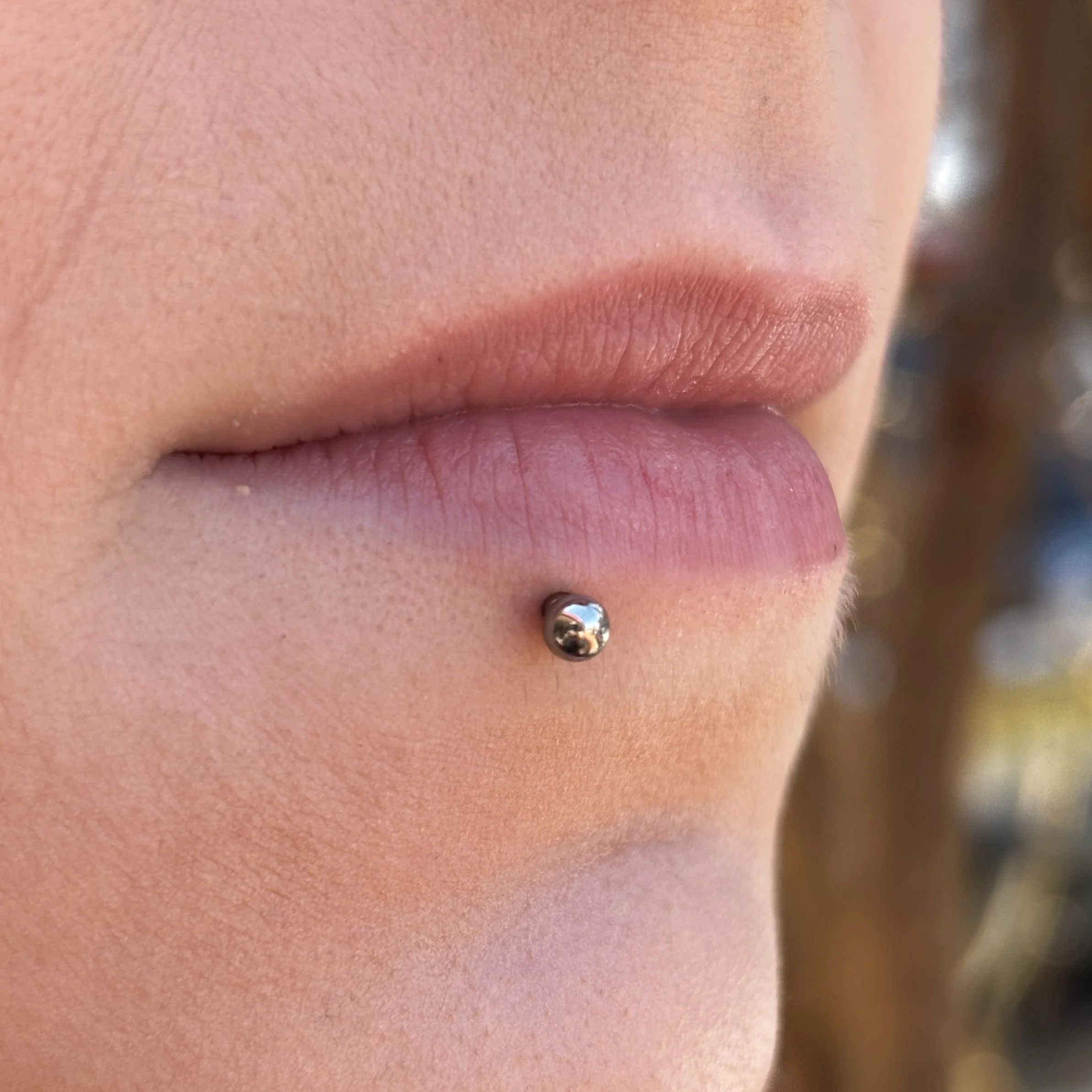 Healed Lower Lip