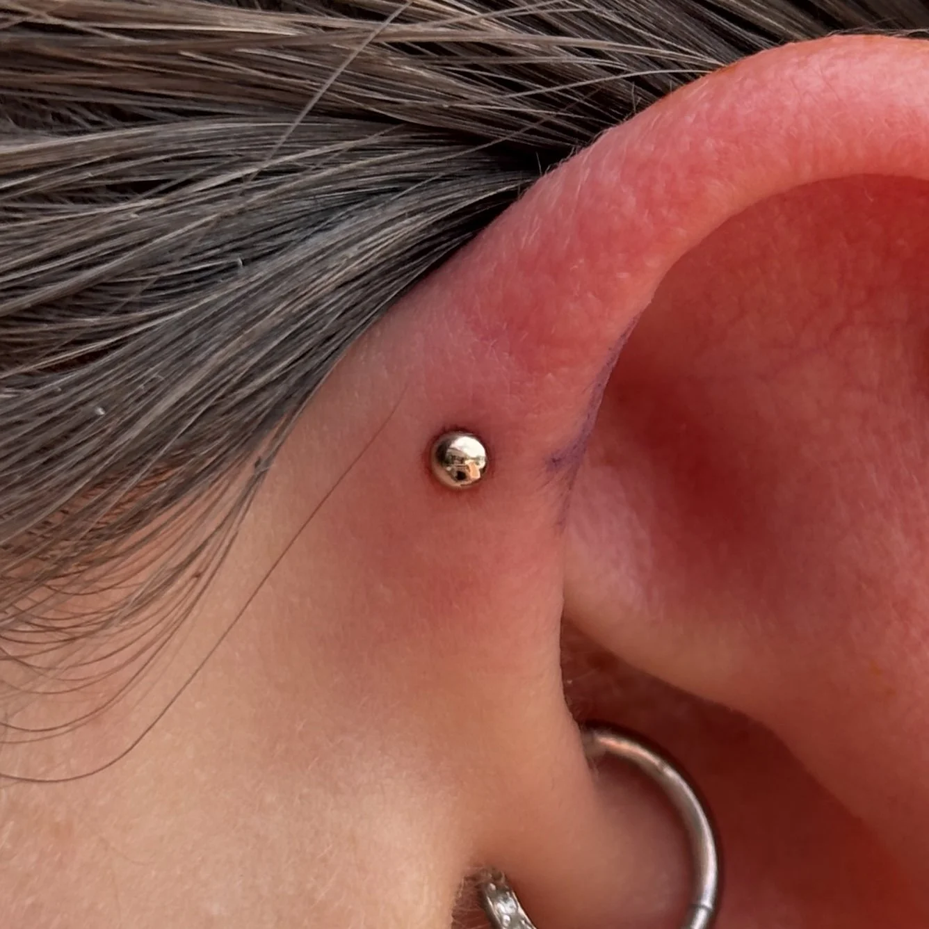 Forward Helix