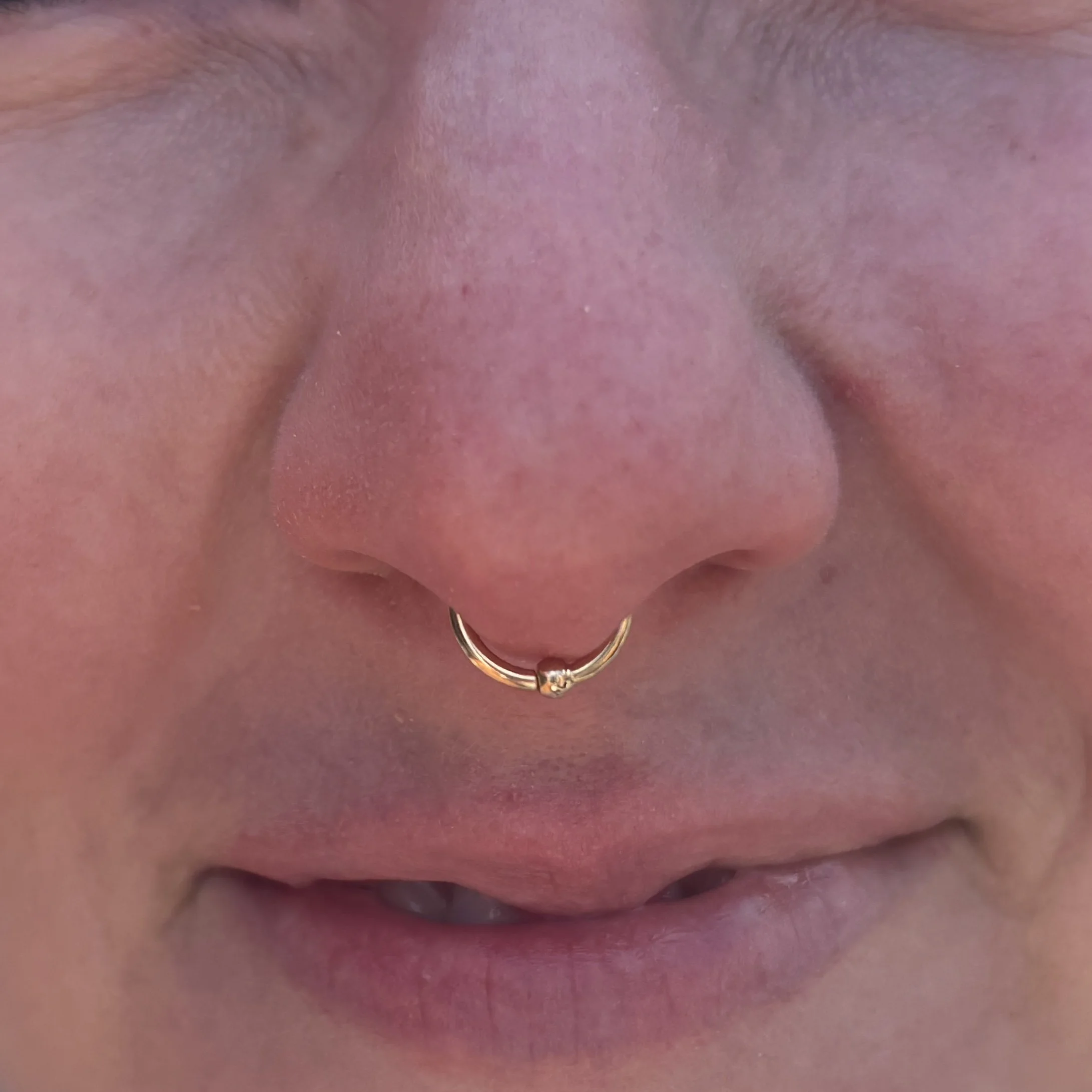 Septum a.JPEG