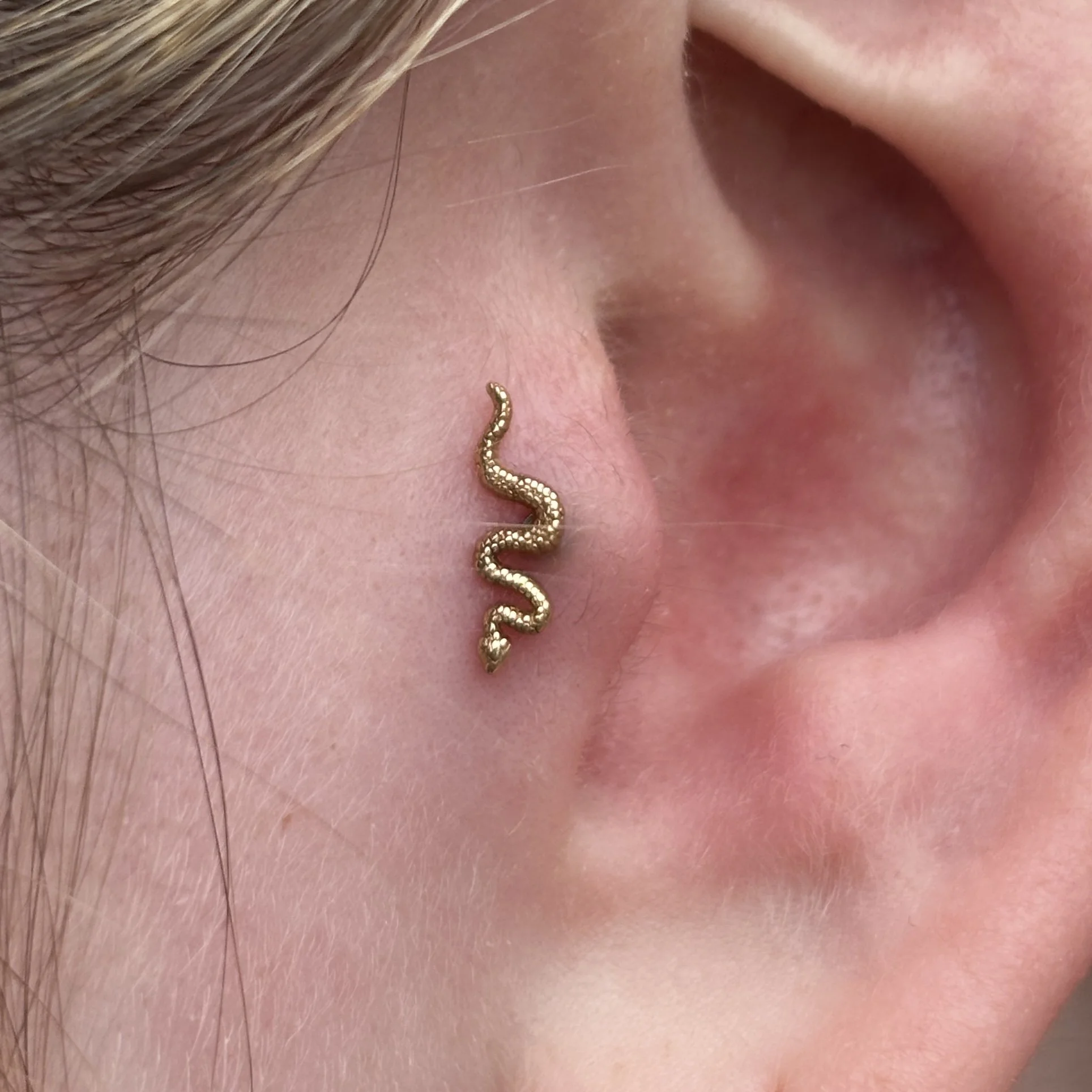 Healed Tragus