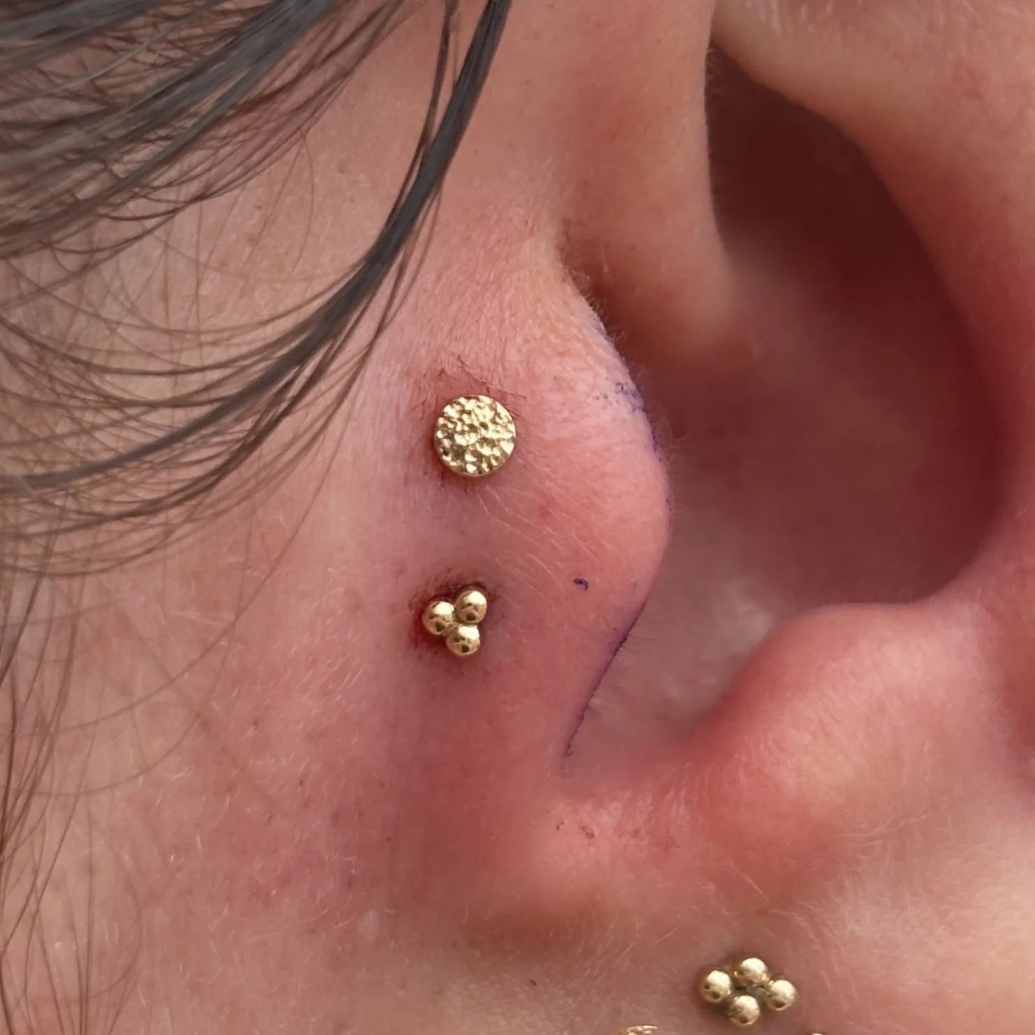 Double Tragus