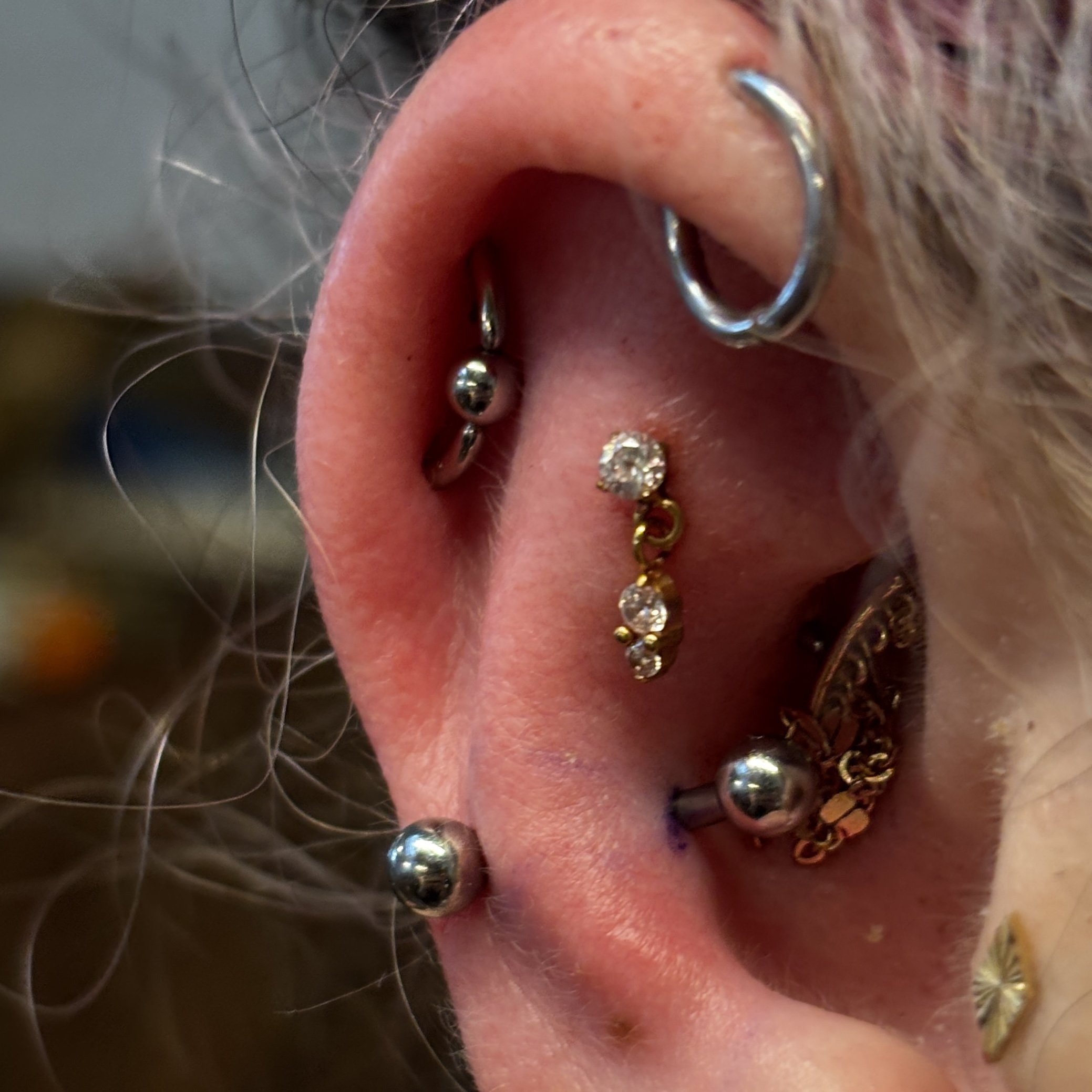 Orbital (connected with healed helix), Snug, & snacked lobe