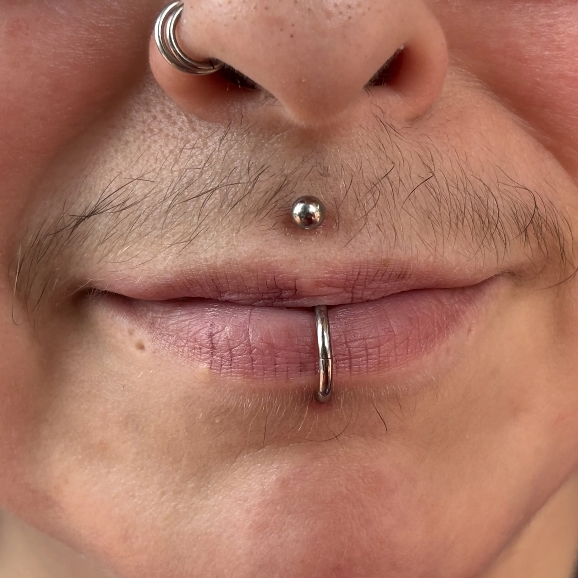 Healed Labret