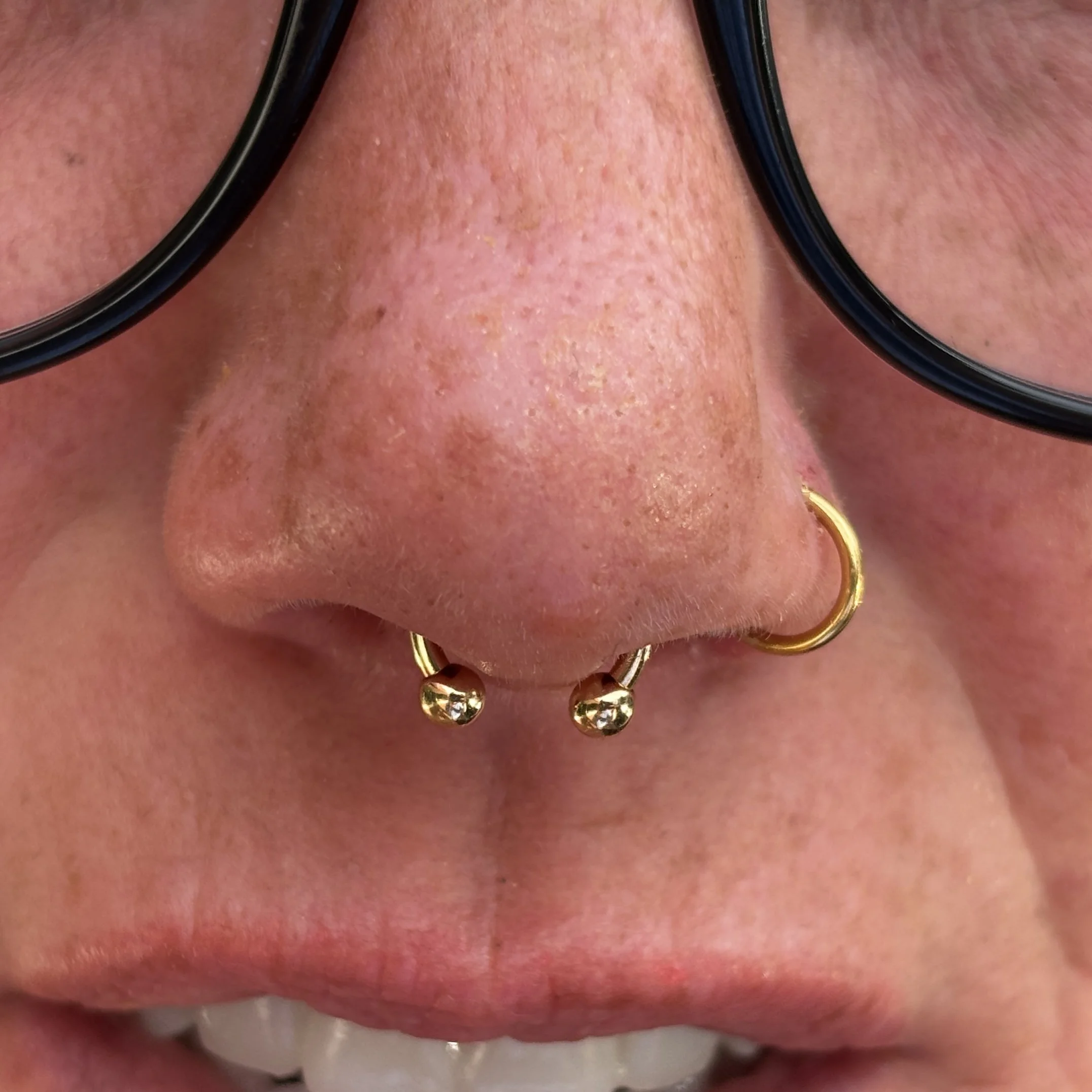 Septum 8a.JPEG
