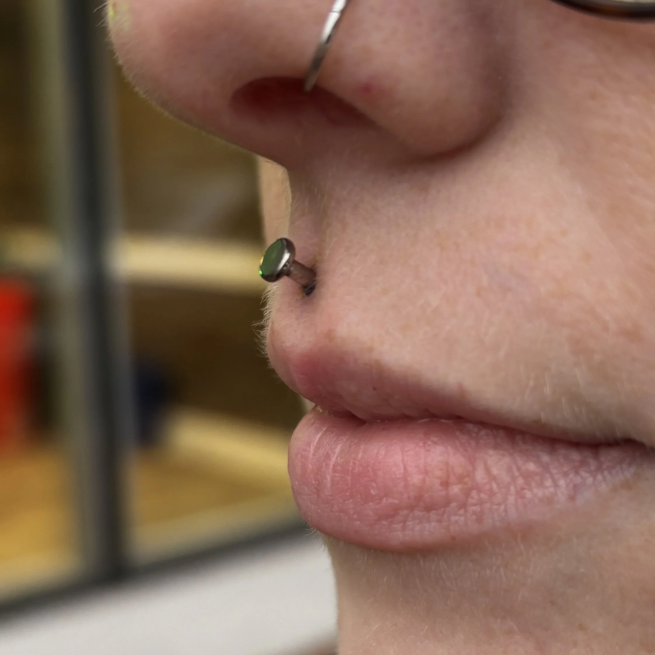 Fresh Philtrum