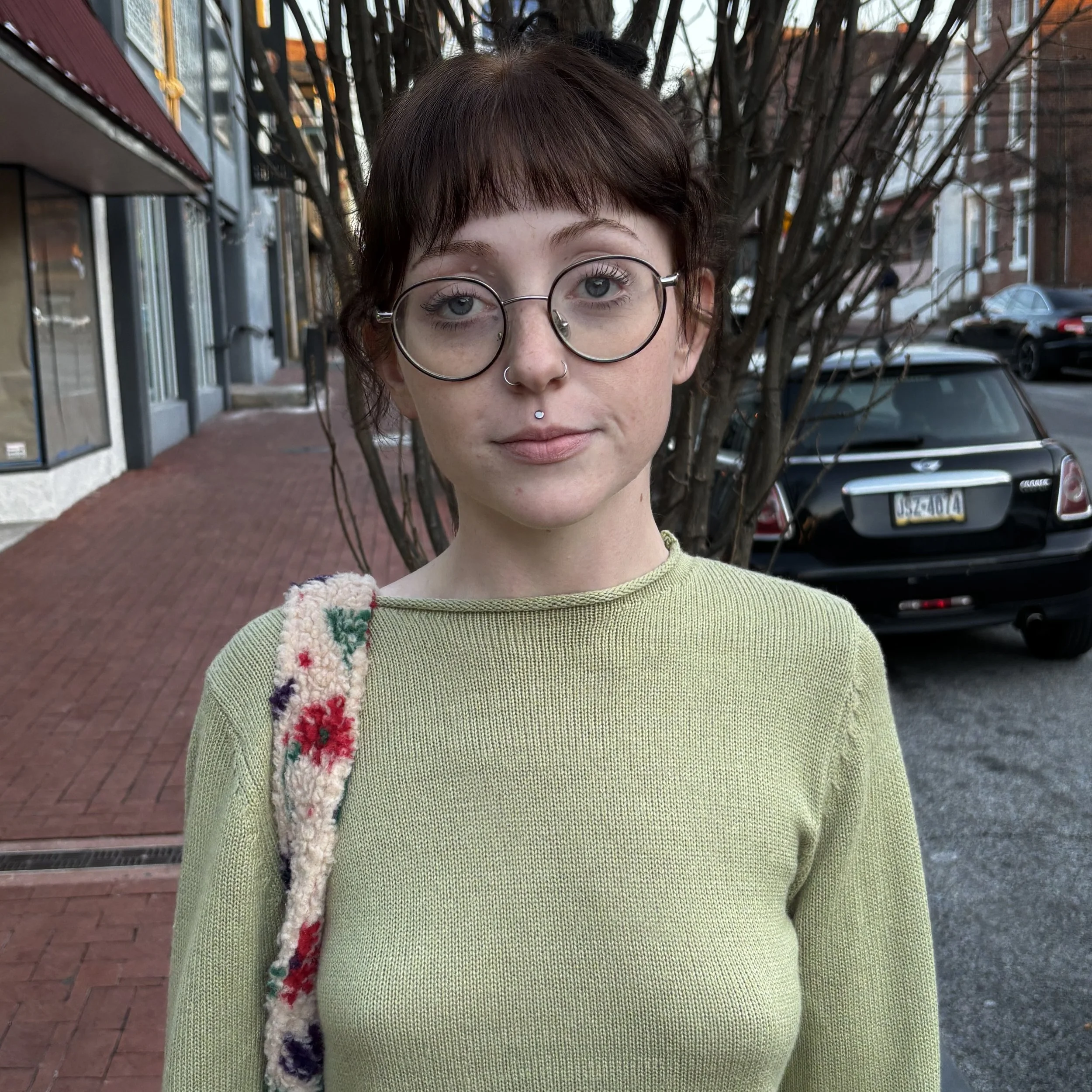 Healed Philtrum