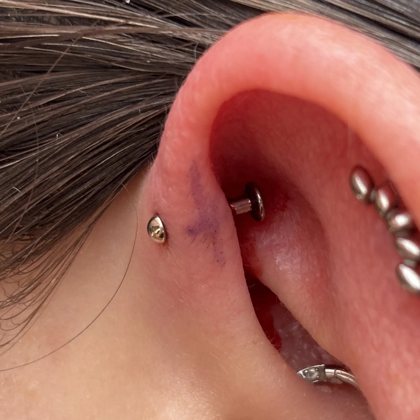 Forward Helix