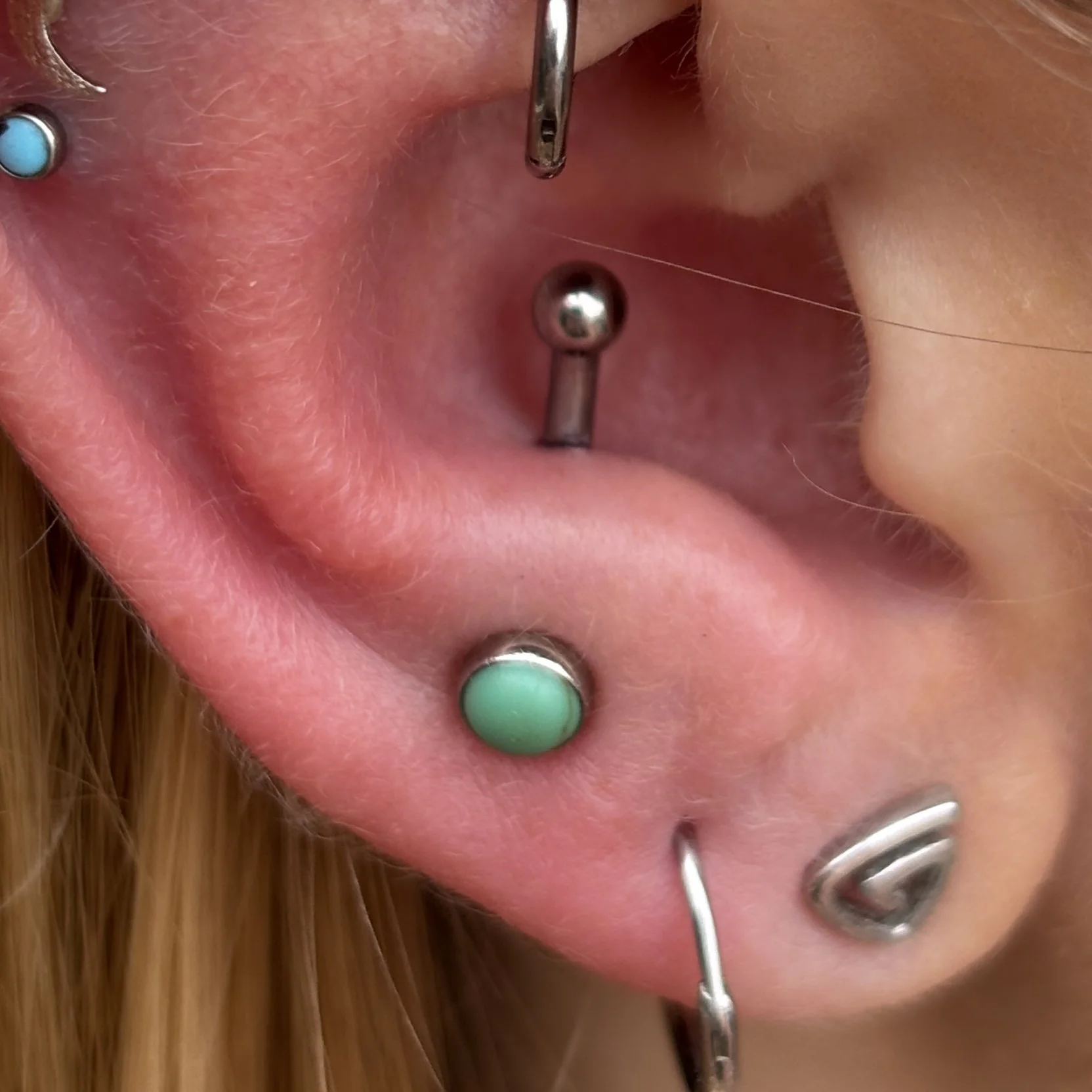 Healed Rook & Fresh Anti-Tragus