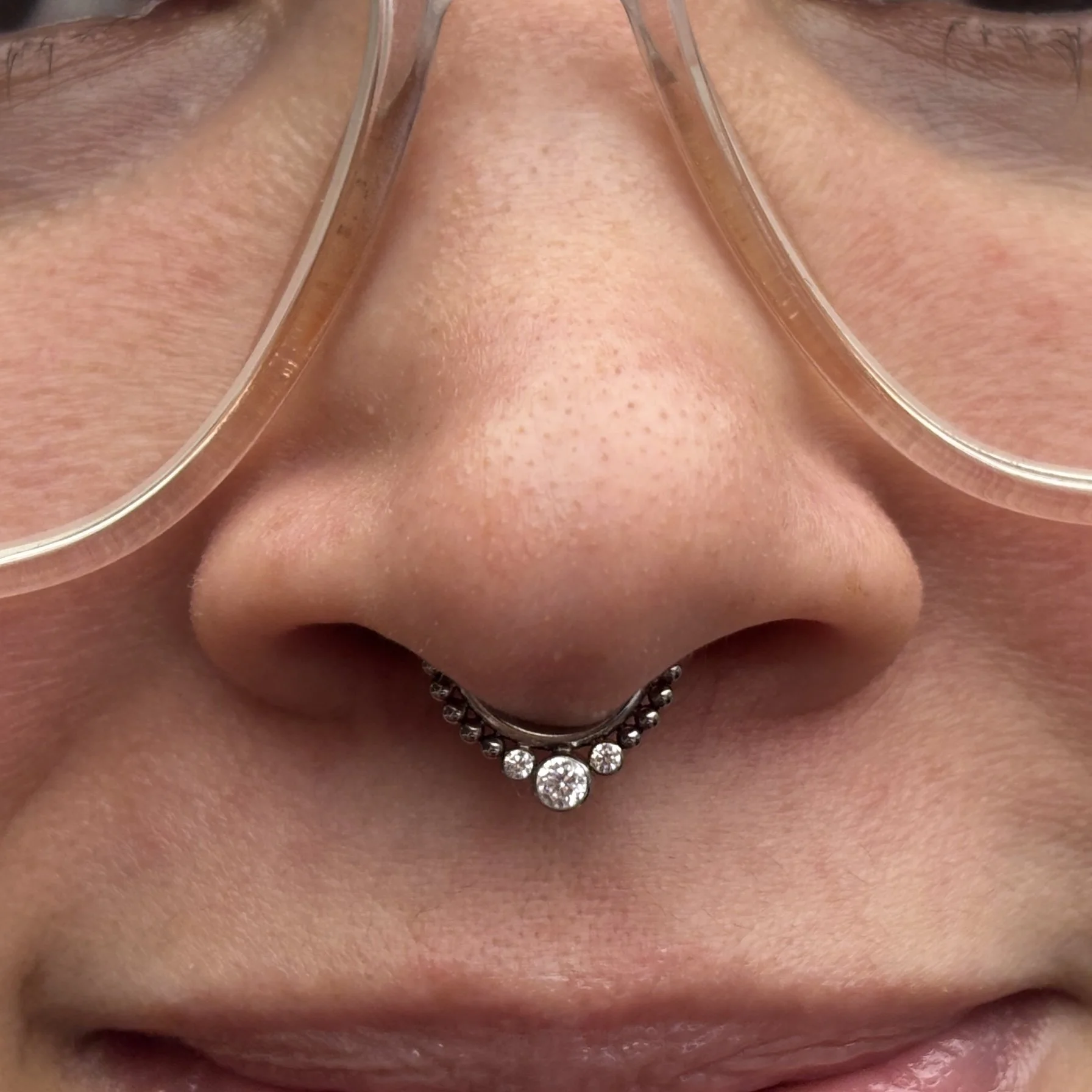 Septum 2b.JPEG