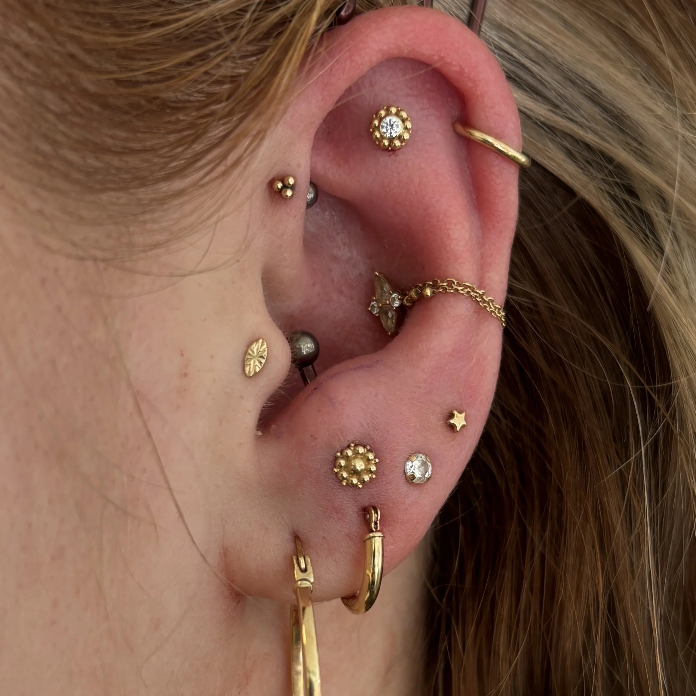 Fresh: Anti-Tragus & Flat, Healed: Outer Helix