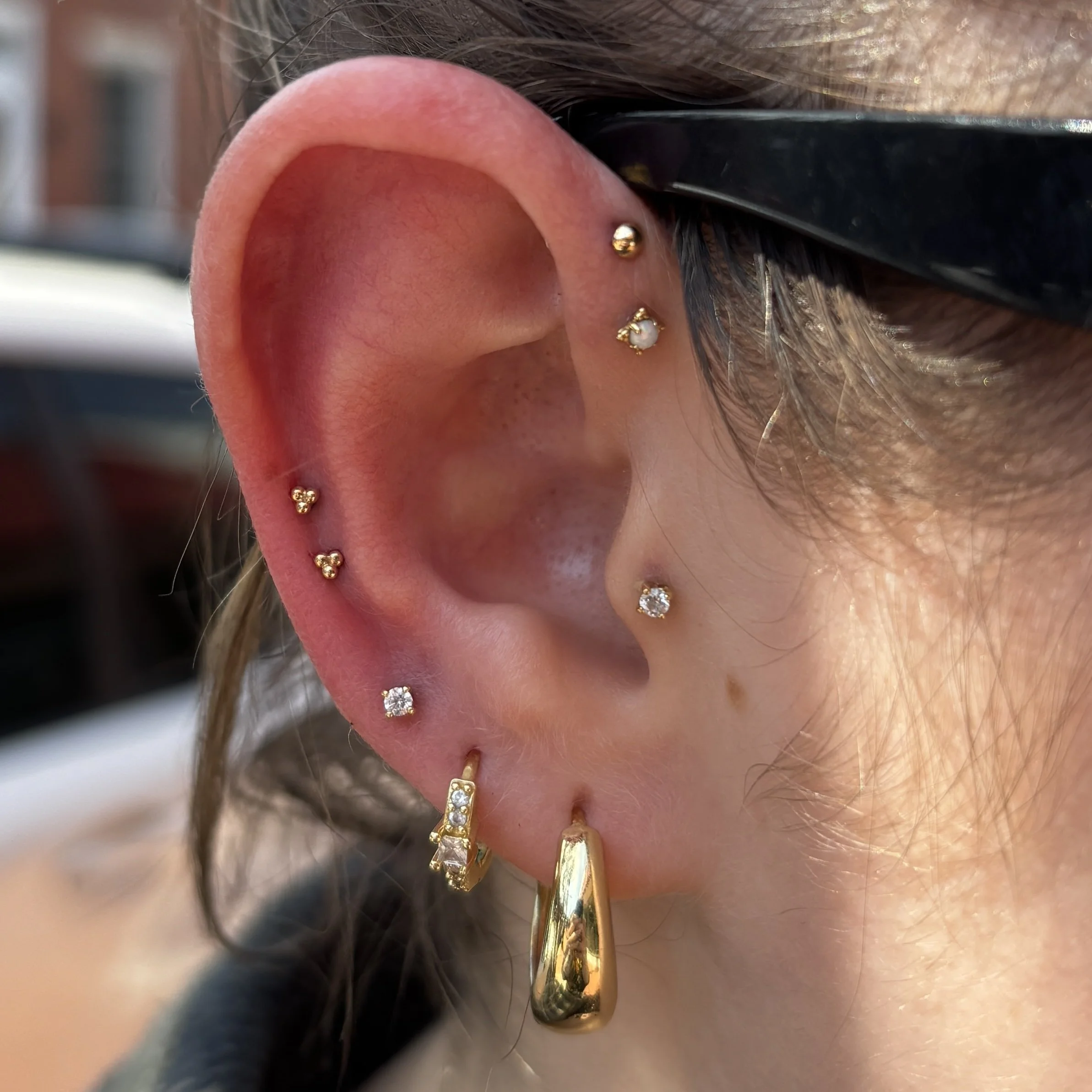 Fresh: Double Mid-Helix & High Forward Helix, Healed: Low Forward Helix & 3rd lobe