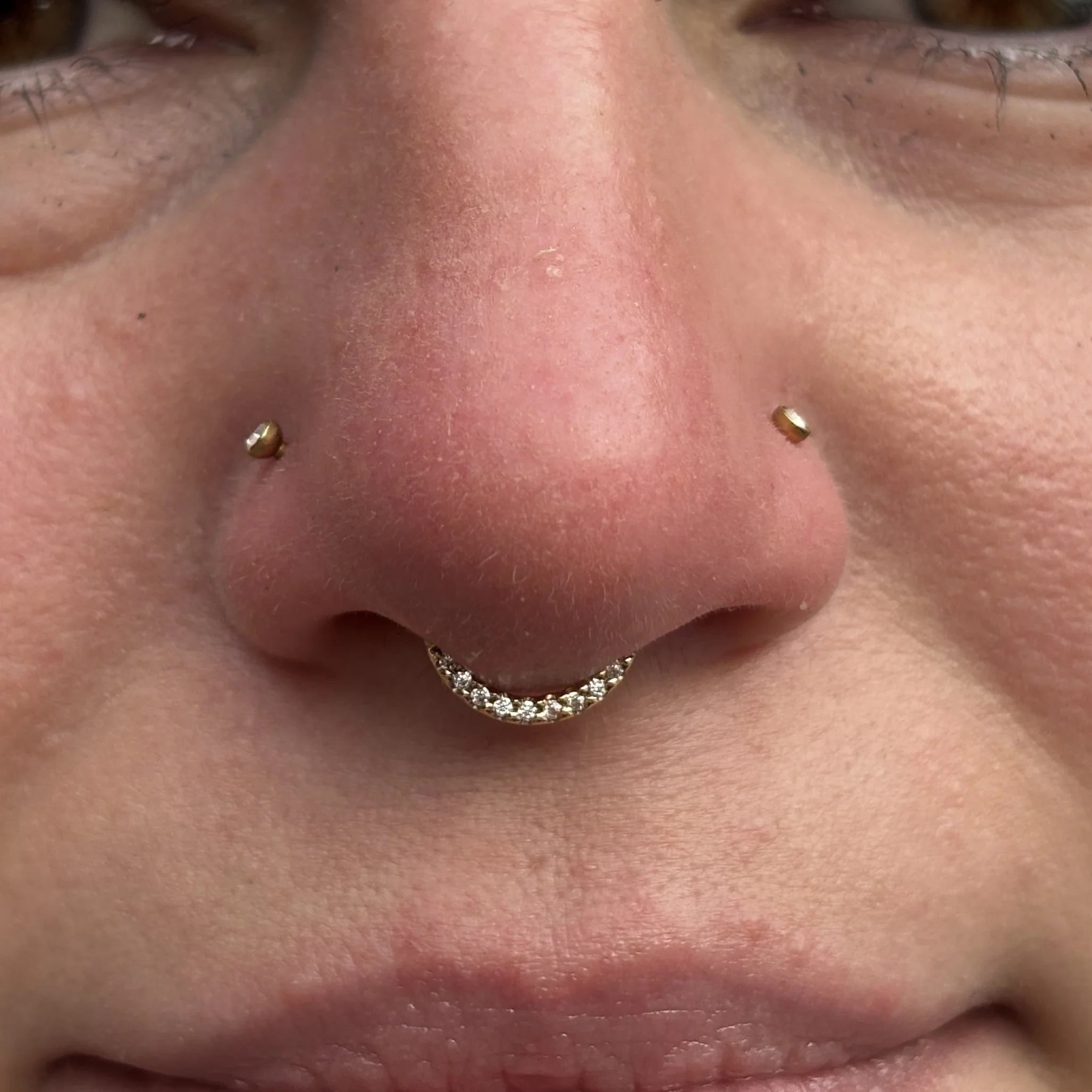 Septum 1a.JPEG