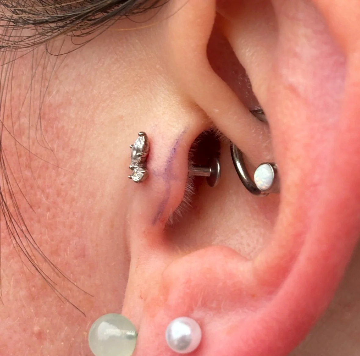 Tragus
