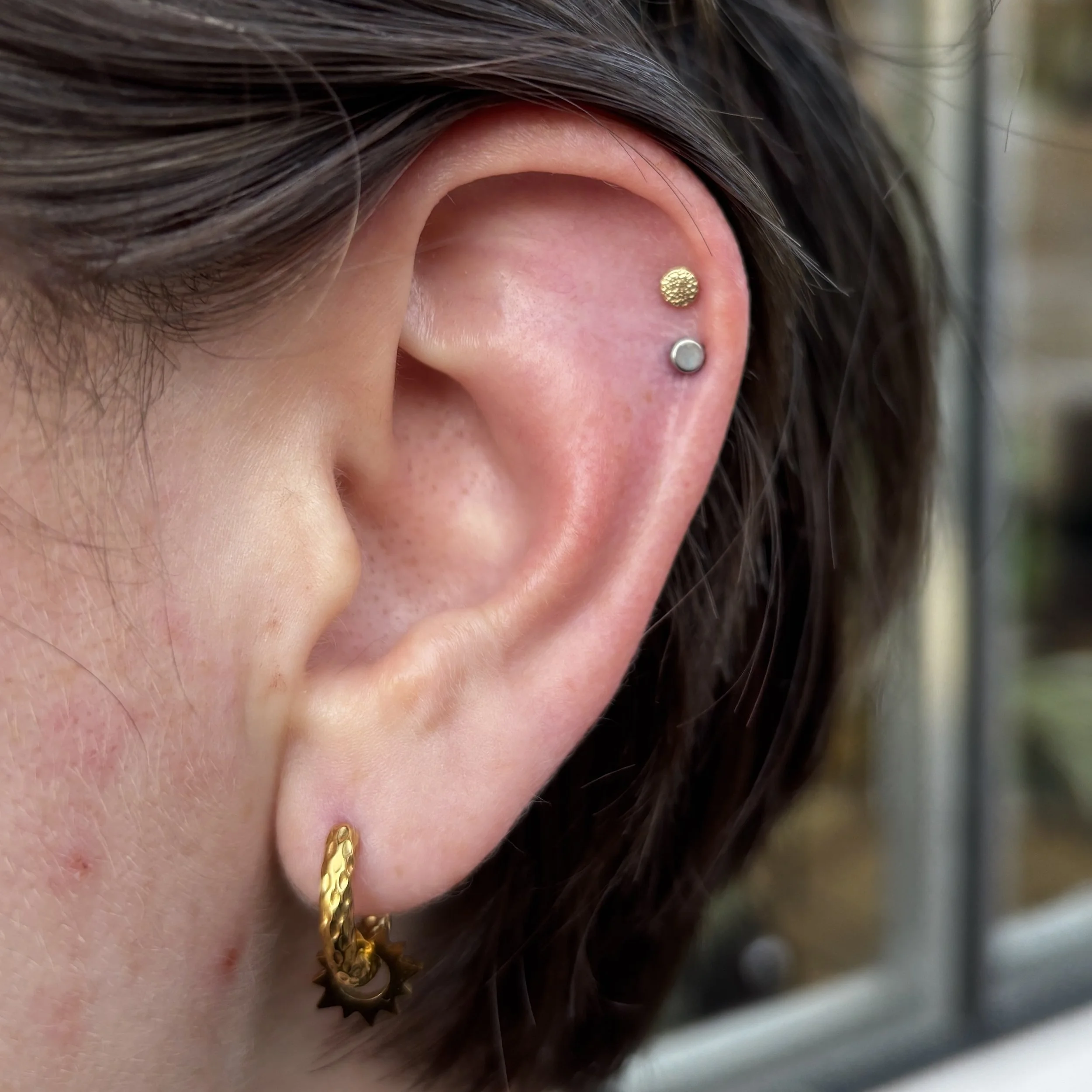 Fresh Lower Helix, Healed Upper Helix
