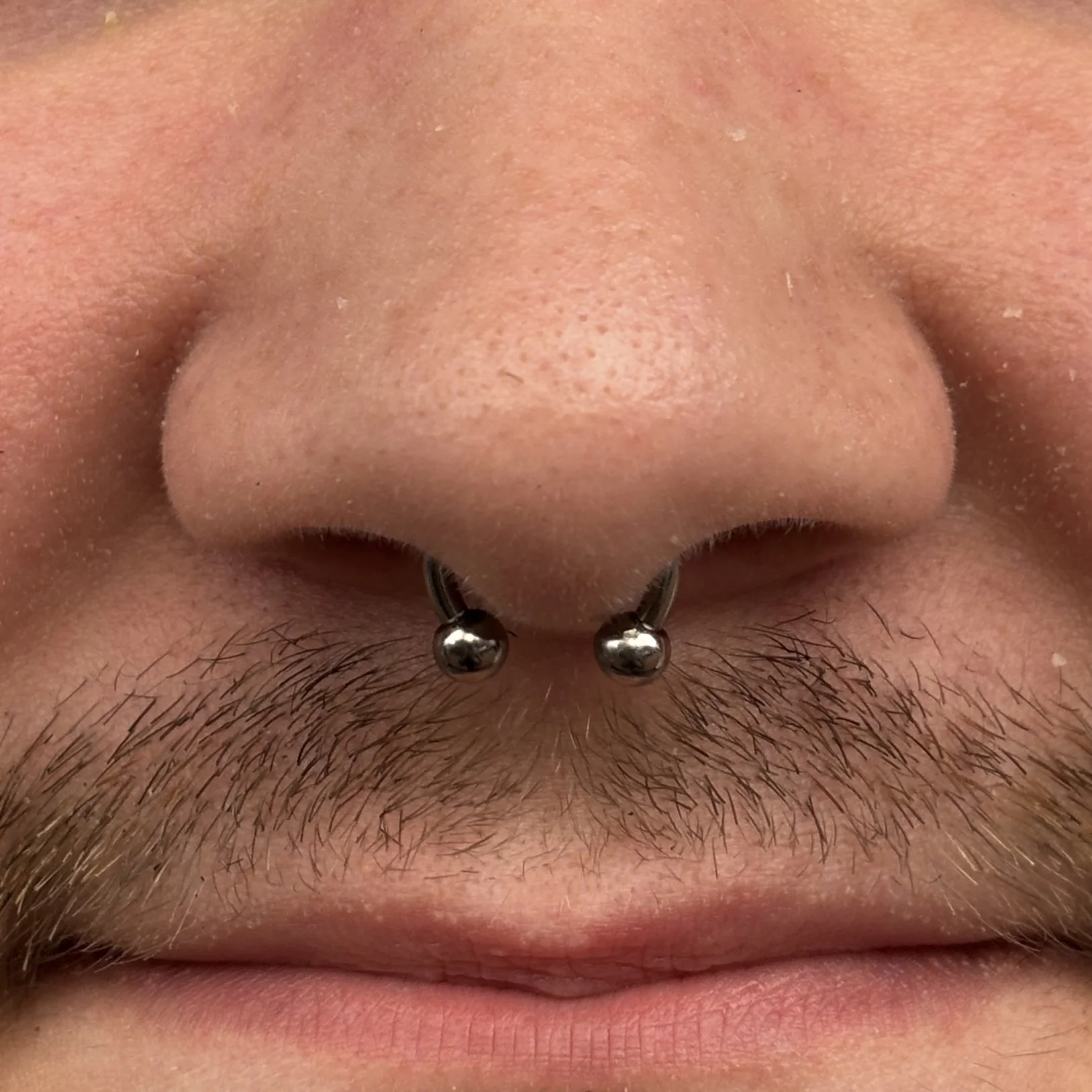 Septum 9a.JPEG