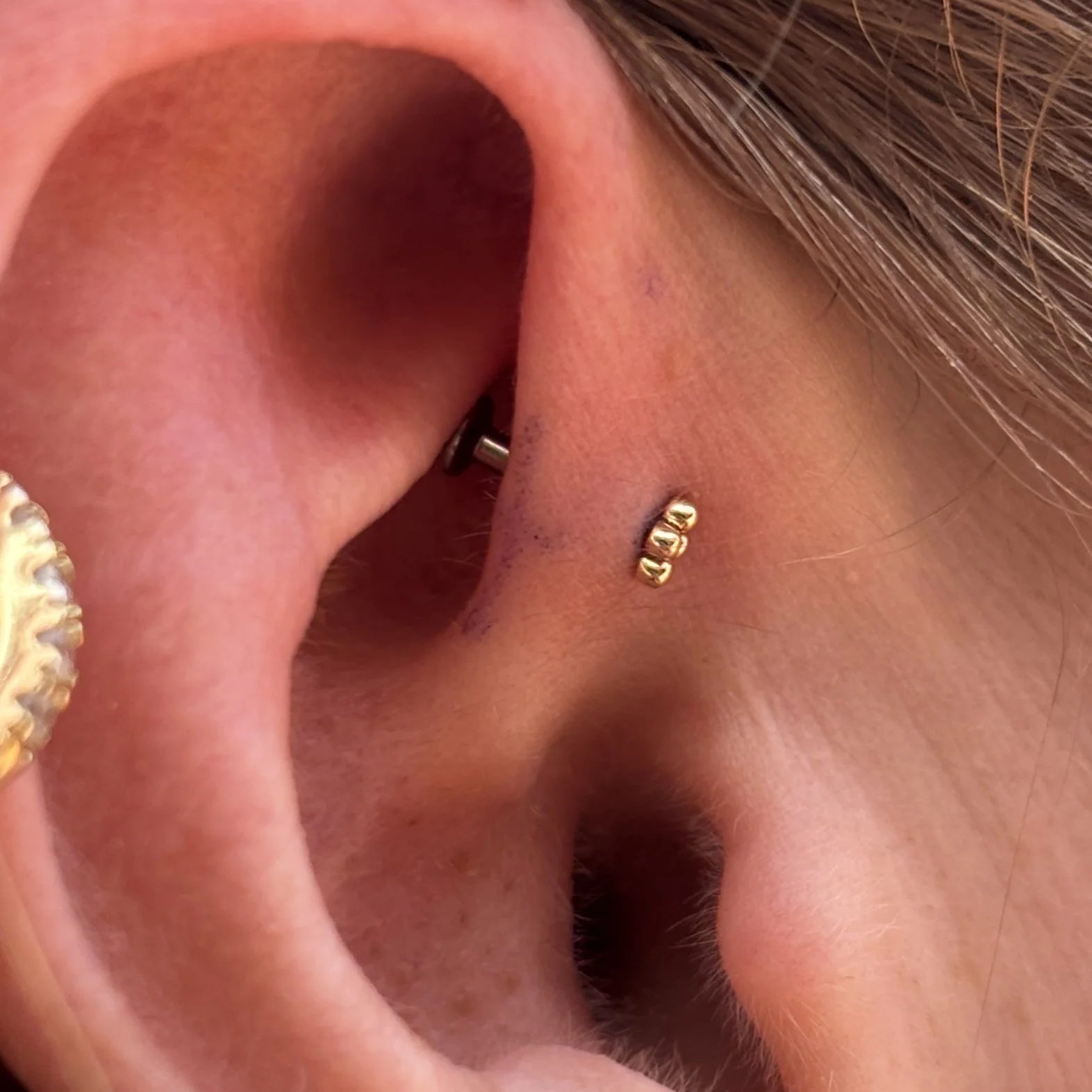 Forward Helix