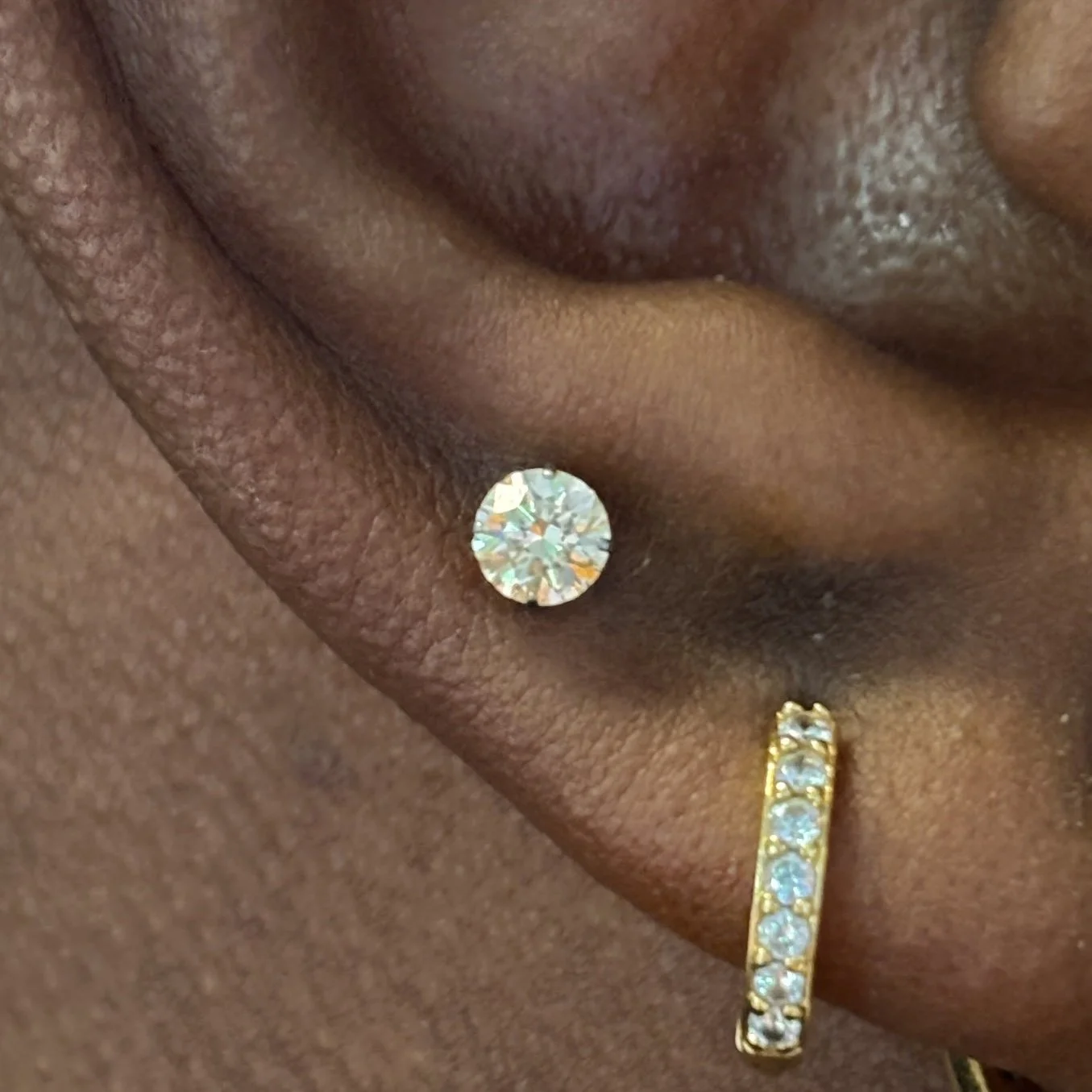 3rd Lobe