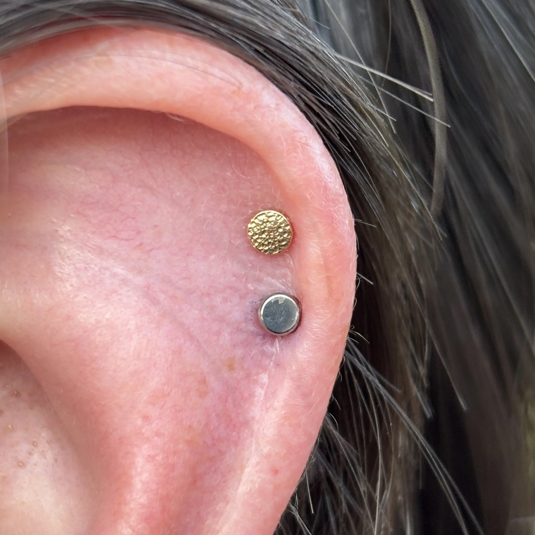 Fresh Lower Helix, Healed Upper Helix