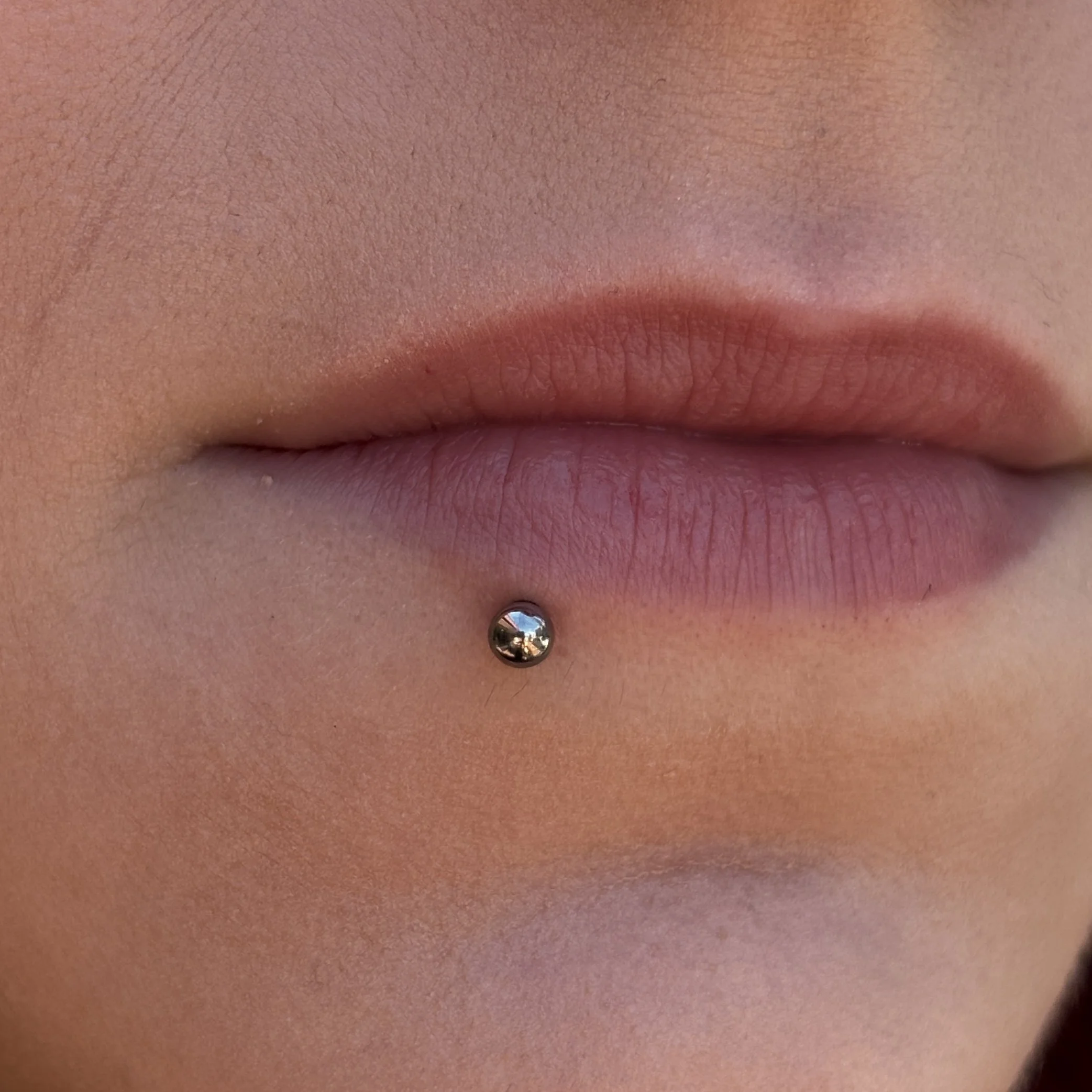 Healed Lower Lip