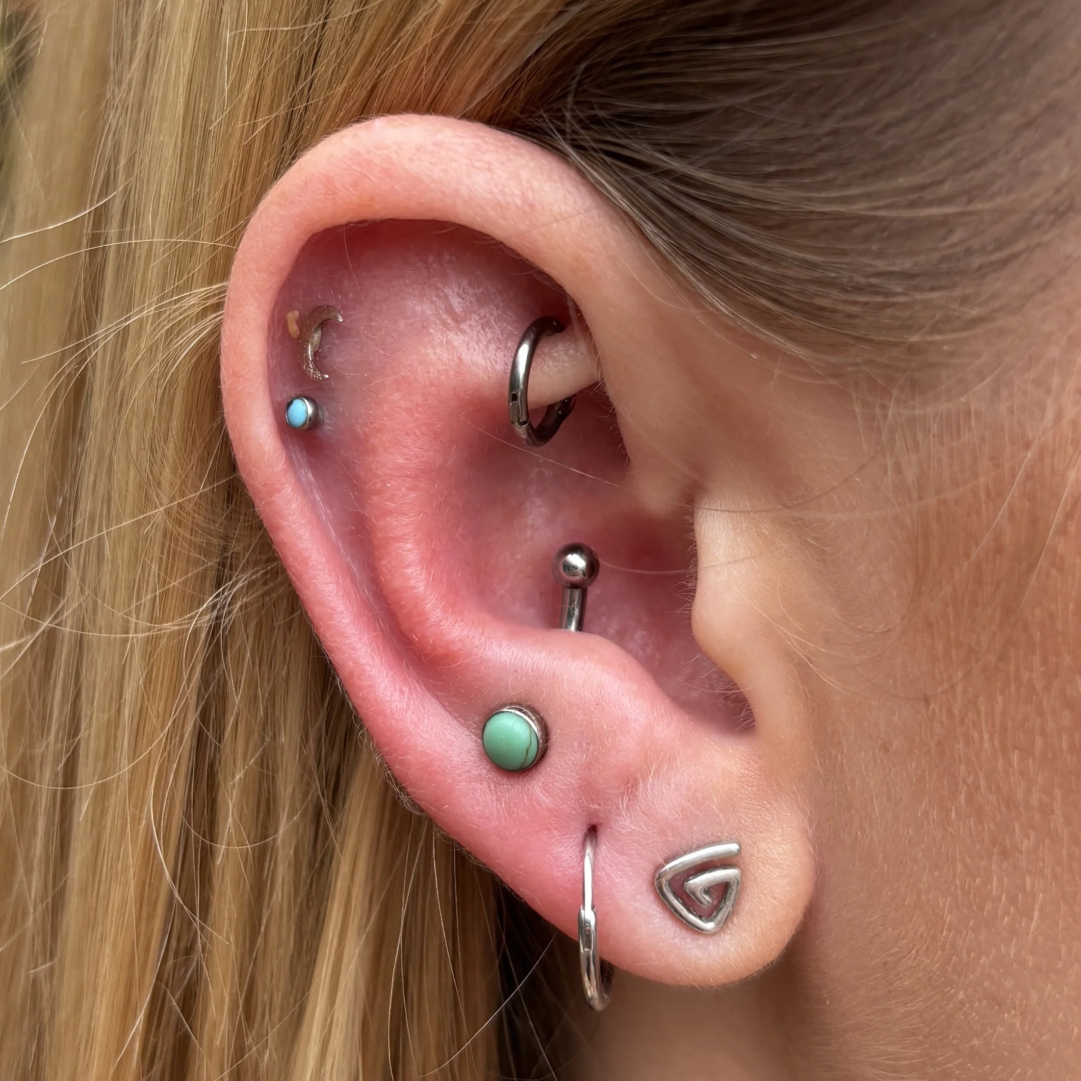 Healed Rook & Fresh Anti-Tragus