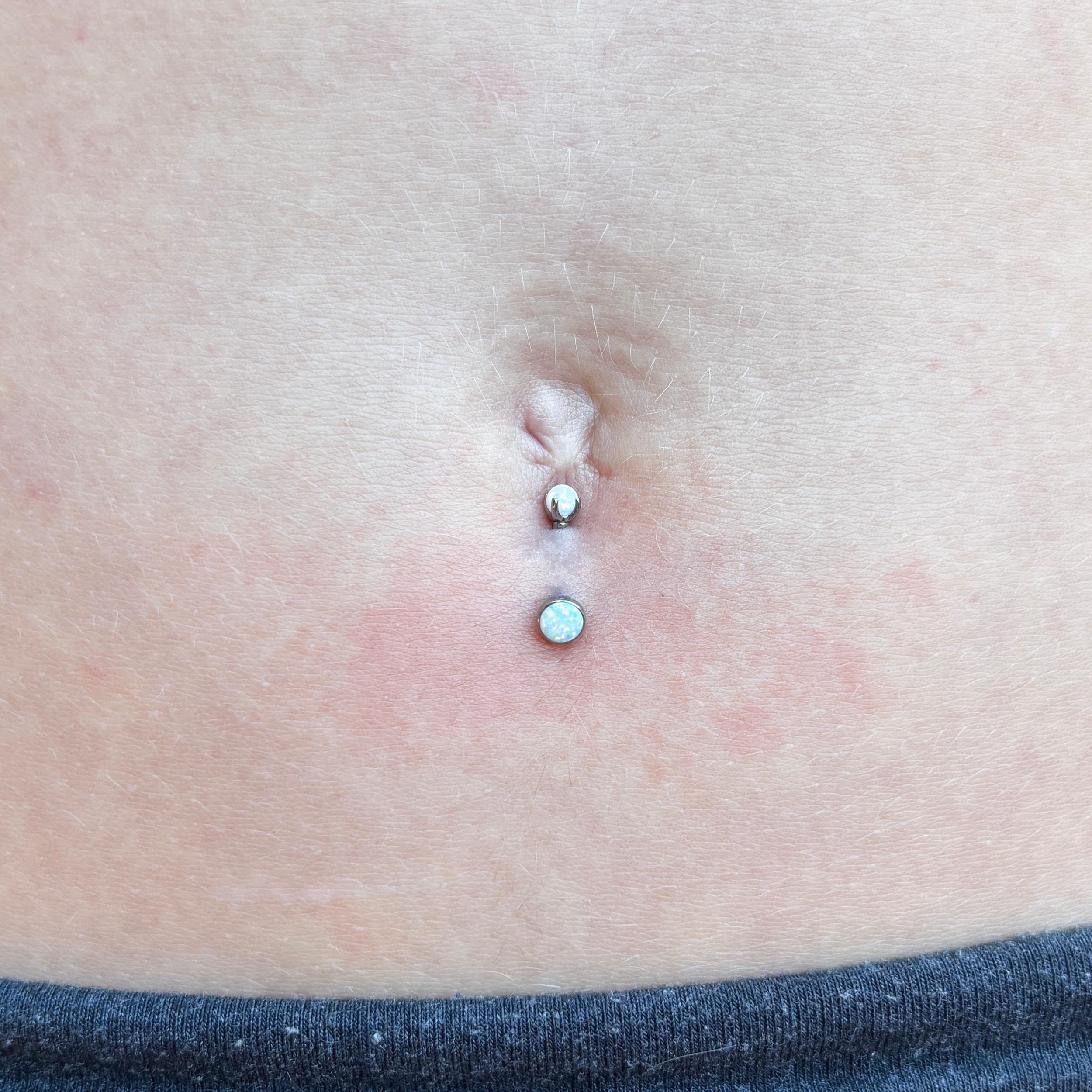Navel 4a.PNG