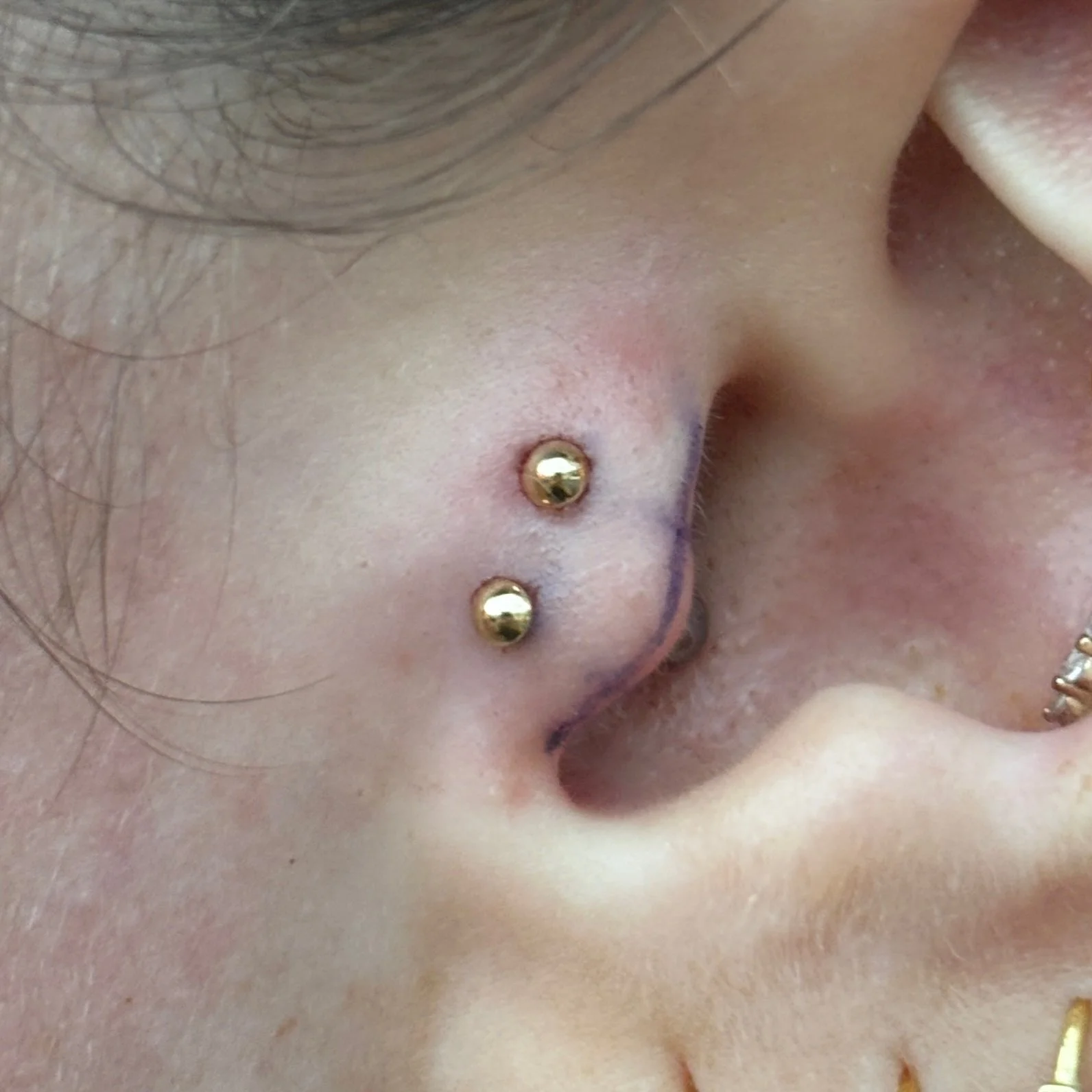 Double Tragus