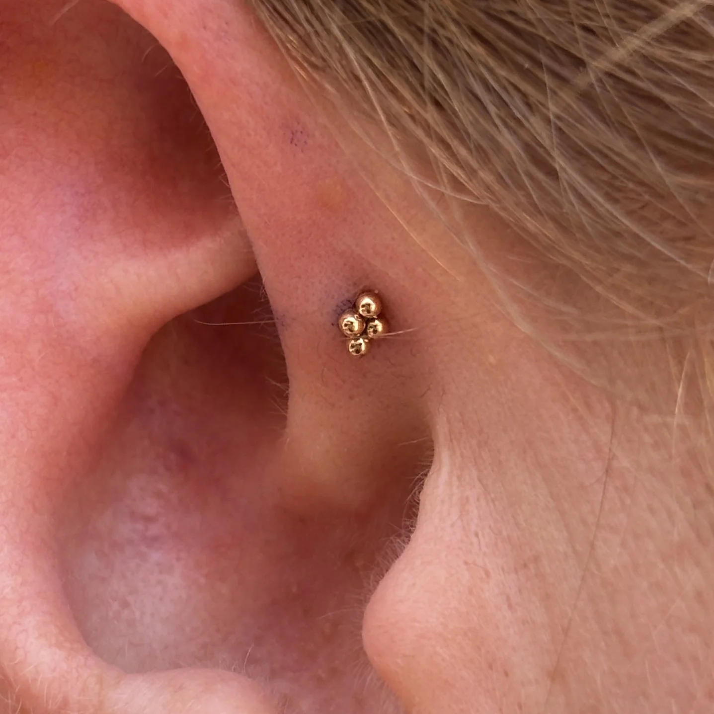 Forward Helix