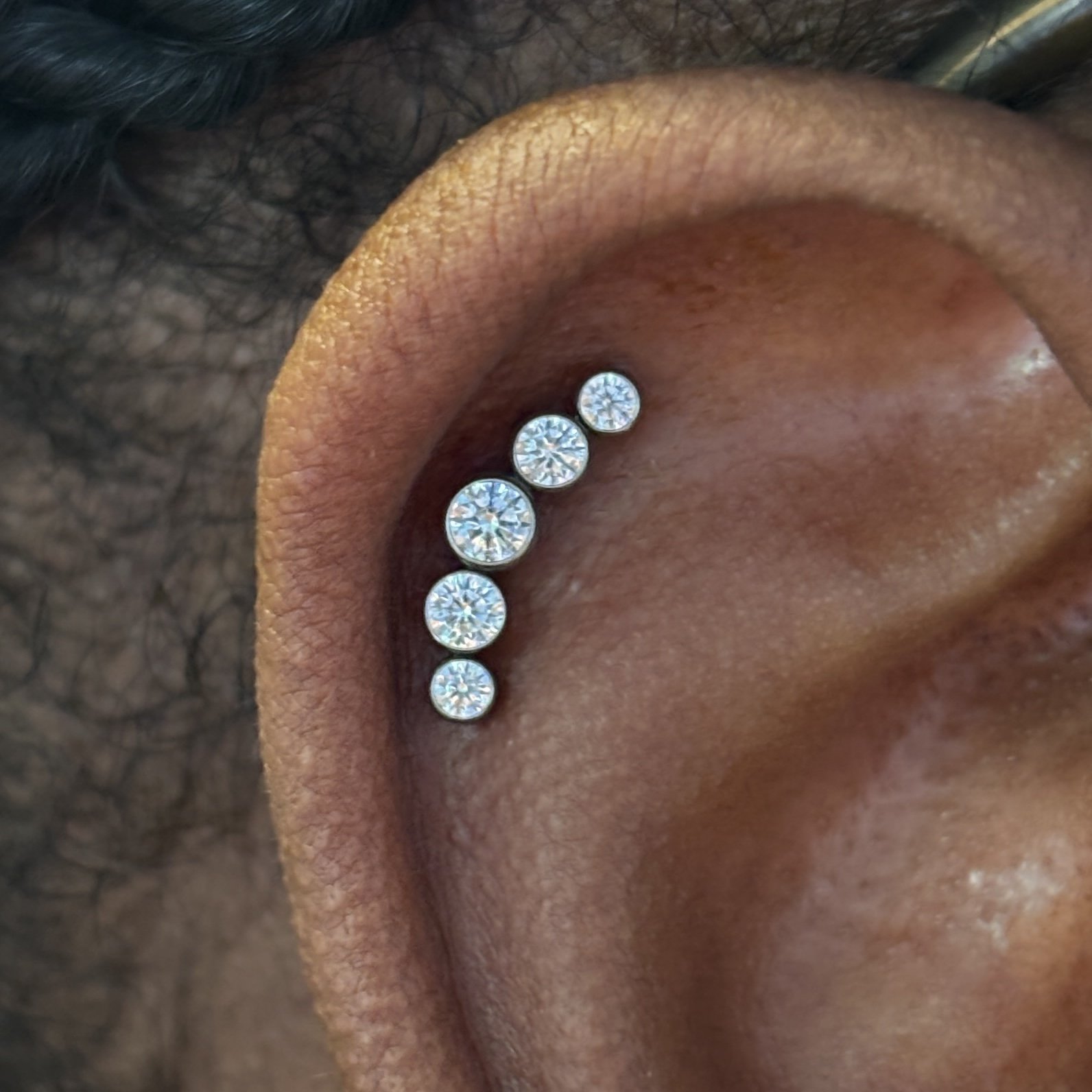 Outer Helix